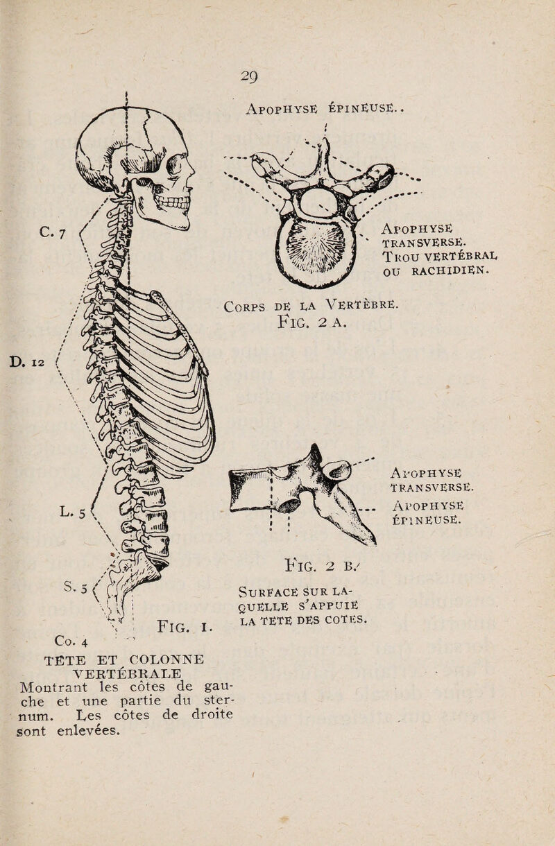 Apophyse épineuse. . C.7 ( D. 12 ( Co. 4 Fig. i. y Corps de la Vertèbre. Fig. 2 a. Apophyse TRANSVËRSË. Apophyse épineuse. SuRËACË SUR LA¬ QUELLE s'appuie LA TETE DES COTES. TÊTE ET COLONNE VERTÉBRALE Montrant les côtes de gau¬ che et une partie du ster¬ num. Ces côtes de droite sont enlevées.