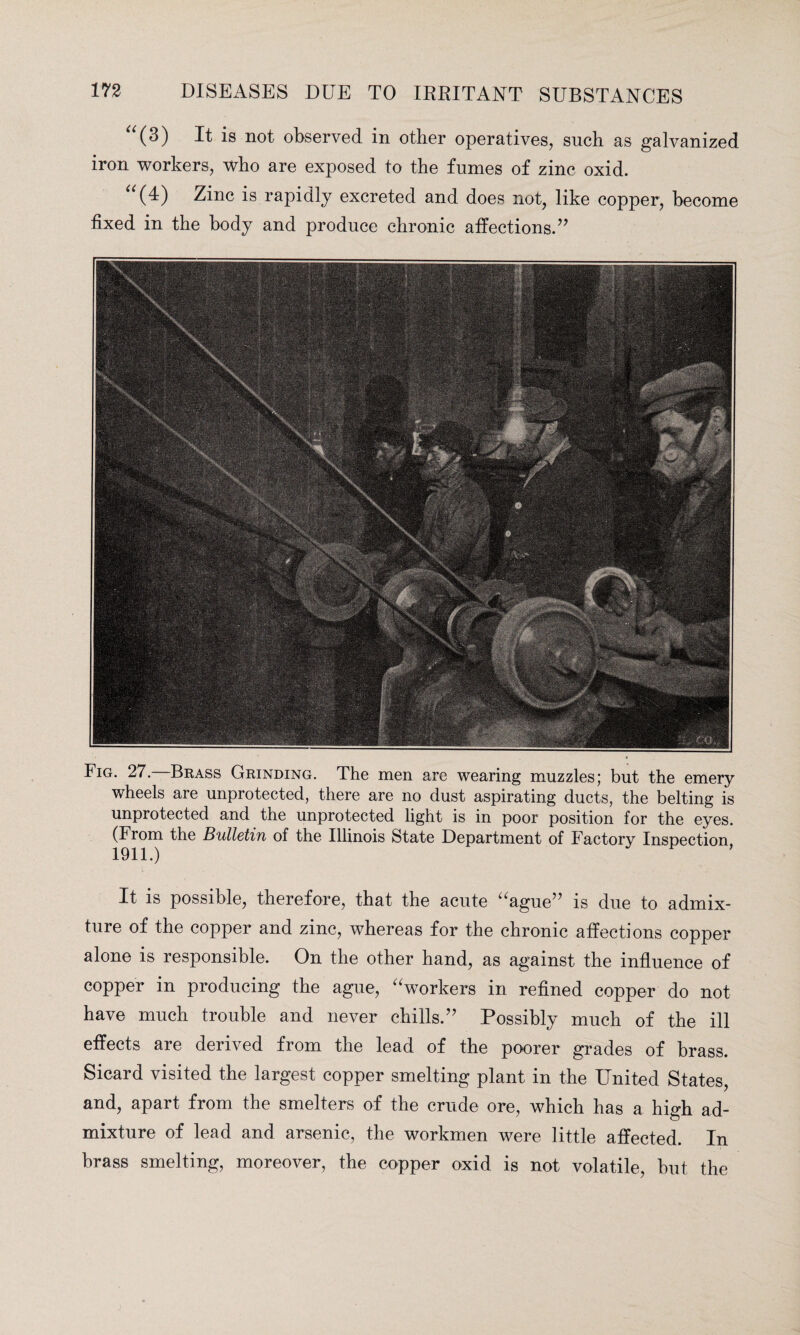 “(3) It is not observed in other operatives, such as galvanized iron workers, who are exposed to the fumes of zinc oxid. “(4) Zinc is rapidly excreted and does not, like copper, become fixed in the body and produce chronic affections.” Fig. 27. Brass Grinding. The men are wearing muzzles; but the emery wheels are unprotected, there are no dust aspirating ducts, the belting is unprotected and the unprotected light is in poor position for the eyes. (From the Bulletin of the Illinois State Department of Factory Inspection 1911.) It is possible, therefore, that the acute “ague” is due to admix¬ ture of the copper and zinc, whereas for the chronic affections copper alone is responsible. On the other hand, as against the influence of copper in producing the ague, “workers in refined copper do not have much trouble and never chills.” Possibly much of the ill effects are derived from the lead of the poorer grades of brass. Sicard visited the largest copper smelting plant in the United States, and, apart from the smelters of the crude ore, which has a high ad¬ mixture of lead and arsenic, the workmen were little affected. In brass smelting, moreover, the copper oxid is not volatile, but the