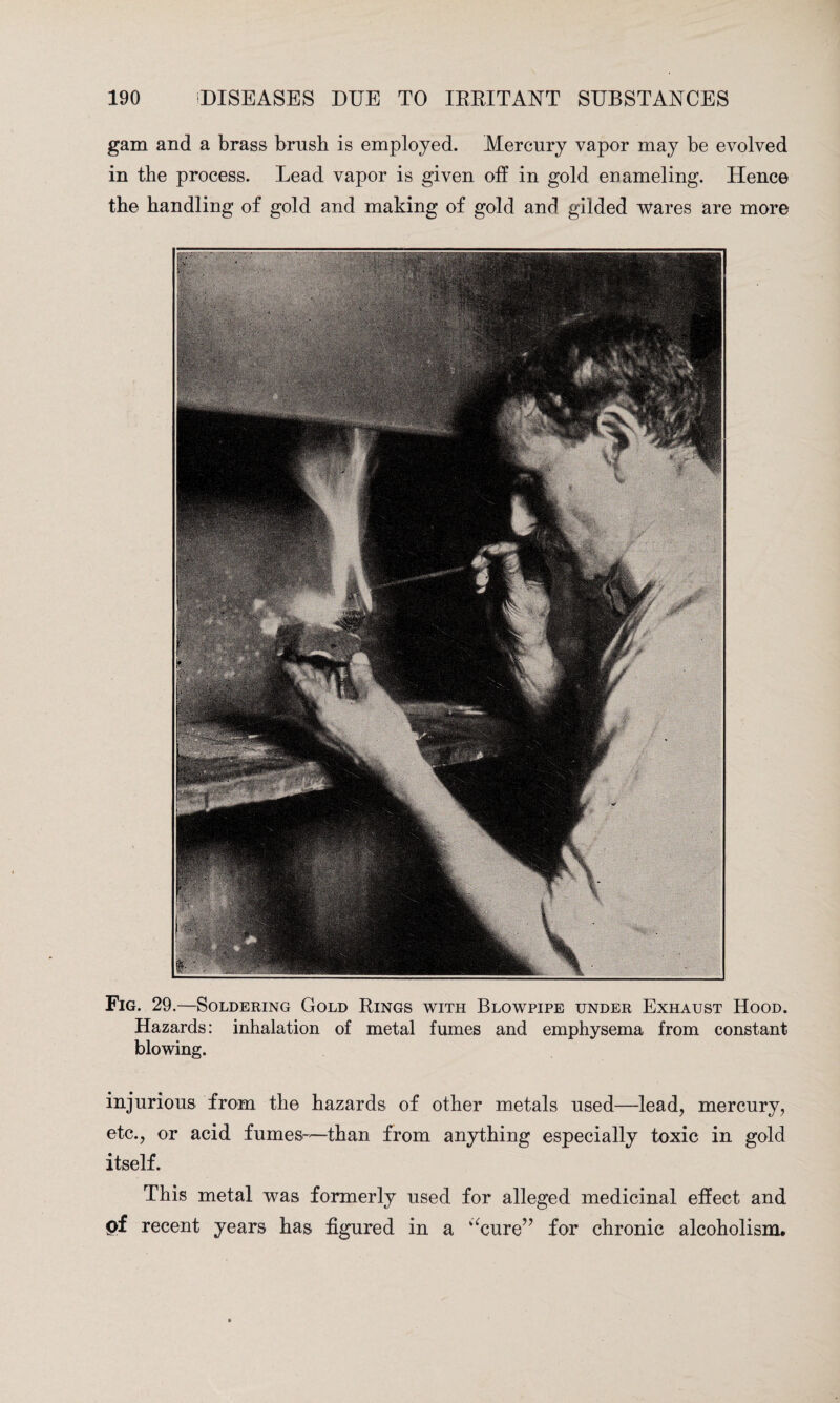 gam and a brass brush is employed. Mercury vapor may be evolved in the process. Lead vapor is given off in gold enameling. Hence the handling of gold and making of gold and gilded wares are more Fig. 29.—Soldering Gold Rings with Blowpipe under Exhaust Hood. Hazards: inhalation of metal fumes and emphysema from constant blowing. injurious from the hazards of other metals used—lead, mercury, etc., or acid fumes—than from anything especially toxic in gold itself. This metal was formerly used for alleged medicinal effect and ef recent years has figured in a “cure” for chronic alcoholism.