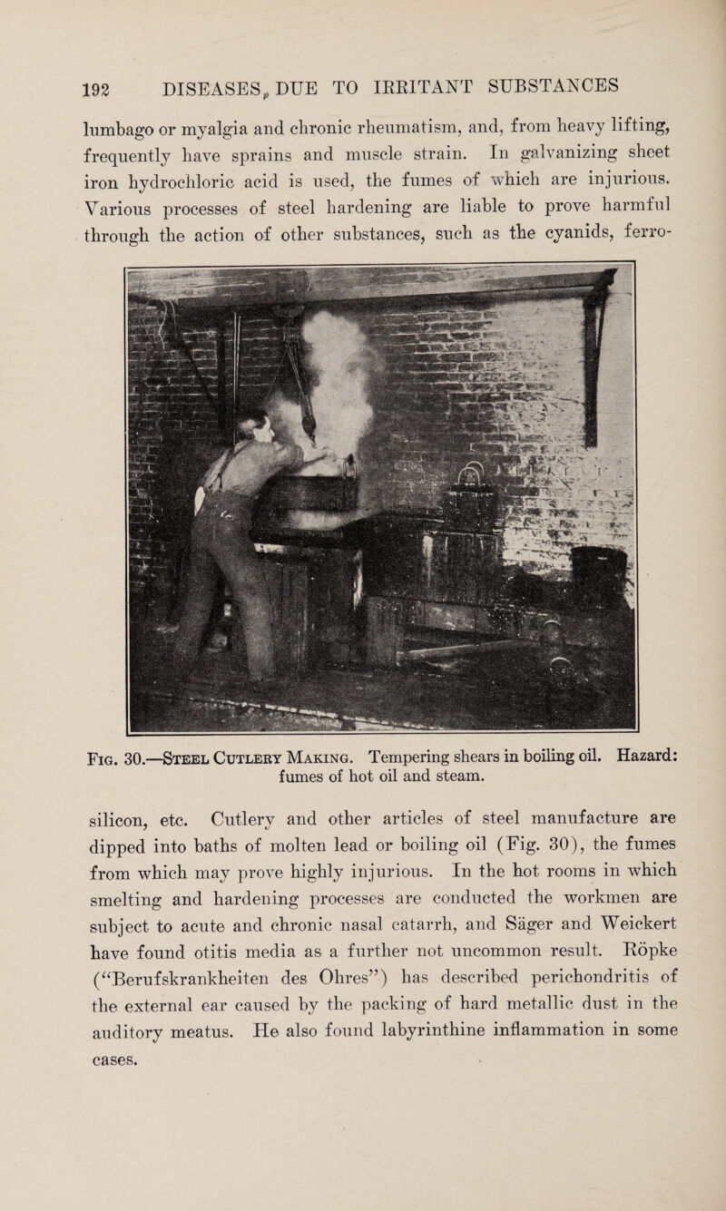 lumbago or myalgia and chronic rheumatism, and, from heavy lifting, frequently have sprains and muscle strain. In galvanizing sheet iron hydrochloric acid is used, the fumes of which are injurious. Various processes of steel hardening are liable to prove harmlul through the action of other substances, such as the cyanids, ferro- Fig. 30.—Steel Cutlery Making. Tempering shears in boiling oil. Hazard: fumes of hot oil and steam. silicon, etc. Cutlery and other articles of steel manufacture are dipped into baths of molten lead or boiling oil (Fig. 30), the fumes from which may prove highly injurious. In the hot rooms in which smelting and hardening processes are conducted the workmen are subject to acute and chronic nasal catarrh, and Sager and Weickert have found otitis media as a further not uncommon result. Ropke (“Berufskrankheiten des Ohres”) has described perichondritis of the external ear caused by the packing of hard metallic dust in the auditory meatus. He also found labyrinthine inflammation in some cases.