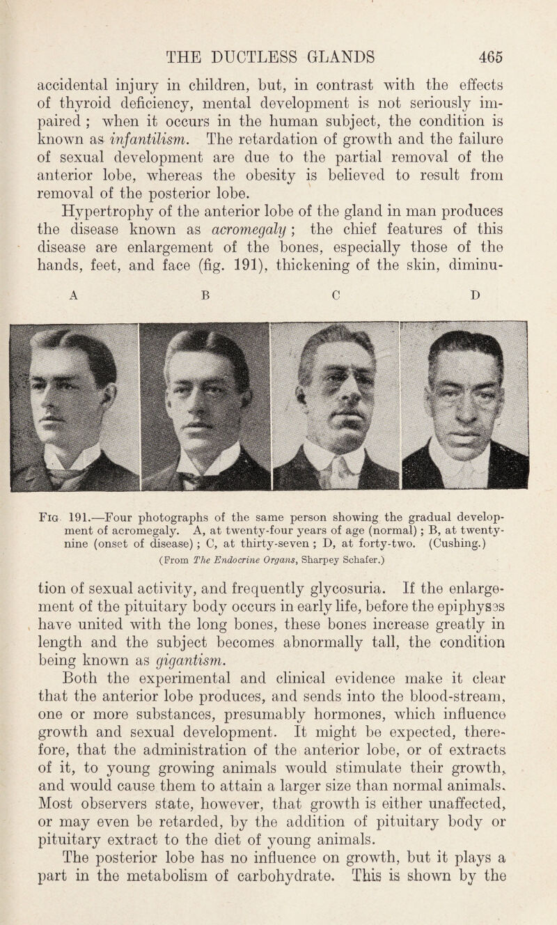 accidental injury in children, but, in contrast with the effects of thyroid deficiency, mental development is not seriously im¬ paired ; when it occurs in the human subject, the condition is known as infantilism. The retardation of growth and the failure of sexual development are due to the partial removal of the anterior lobe, whereas the obesity is believed to result from removal of the posterior lobe. Hypertrophy of the anterior lobe of the gland in man produces the disease known as acromegaly ; the chief features of this disease are enlargement of the bones, especially those of the hands, feet, and face (fig. 191), thickening of the skin, diminu- A B C D Fig 191.—Four photographs of the same person showing the gradual develop¬ ment of acromegaly. A, at twenty-four years of age (normal); B, at twenty- nine (onset of disease) ; C, at thirty-seven ; D, at forty-two. (Cushing.) (Prom The Endocrine Organs, Sharpey Schafer.) tion of sexual activity, and frequently glycosuria. If the enlarge¬ ment of the pituitary body occurs in early life, before the epiphyses have united with the long bones, these bones increase greatly in length and the subject becomes abnormally tall, the condition being known as gigantism. Both the experimental and clinical evidence make it clear that the anterior lobe produces, and sends into the blood-stream, one or more substances, presumably hormones, which influence growth and sexual development. It might be expected, there¬ fore, that the administration of the anterior lobe, or of extracts of it, to young growing animals would stimulate their growth, and would cause them to attain a larger size than normal animals. Most observers state, however, that growth is either unaffected, or may even be retarded, by the addition of pituitary body or pituitary extract to the diet of young animals. The posterior lobe has no influence on growth, but it plays a part in the metabolism of carbohydrate. This is shown by the