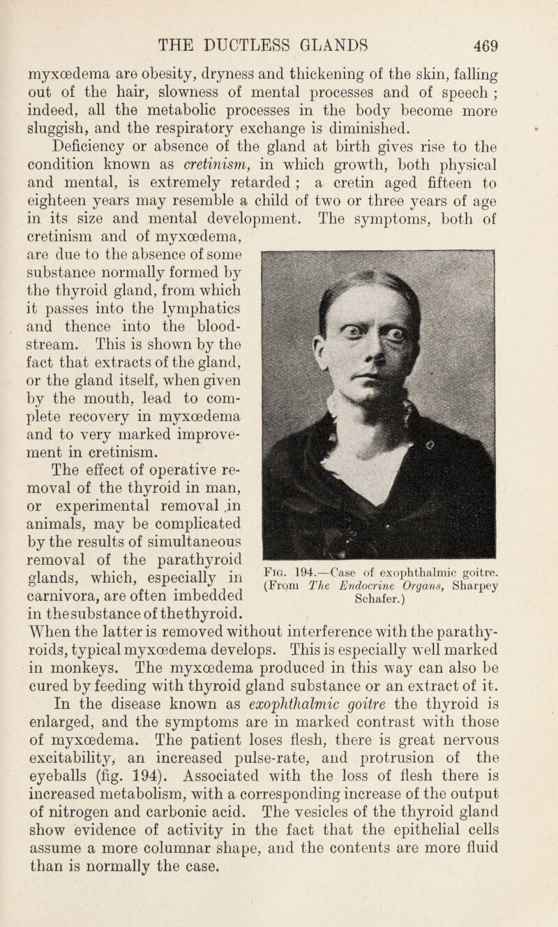 myxcedema are obesity, dryness and thickening of the skin, falling out of the hair, slowness of mental processes and of speech ; indeed, all the metabolic processes in the body become more sluggish, and the respiratory exchange is diminished. Deficiency or absence of the gland at birth gives rise to the condition known as cretinism, in which growth, both physical and mental, is extremely retarded ; a cretin aged fifteen to eighteen years may resemble a child of two or three years of age in its size and mental development. The symptoms, both of cretinism and of myxoedema, are due to the absence of some substance normally formed by the thyroid gland, from which it passes into the lymphatics and thence into the blood¬ stream. This is shown by the fact that extracts of the gland, or the gland itself, when given by the mouth, lead to com¬ plete recovery in myxoedema and to very marked improve¬ ment in cretinism. The effect of operative re¬ moval of the thyroid in man, or experimental removal .in animals, may be complicated by the results of simultaneous removal of the parathyroid glands, which, especially in carnivora, are often imbedded in thesubstance of thethyroid. When the latter is removed without interference with the parathy¬ roids, typical myxoedema develops. This is especially well marked in monkeys. The myxcedema produced in this way can also be cured by feeding with thyroid gland substance or an extract of it. In the disease known as exophthalmic goitre the thyroid is enlarged, and the symptoms are in marked contrast with those of myxoedema. The patient loses flesh, there is great nervous excitability, an increased pulse-rate, and protrusion of the eyeballs (fig. 194). Associated with the loss of flesh there is increased metabolism, with a corresponding increase of the output of nitrogen and carbonic acid. The vesicles of the thyroid gland show evidence of activity in the fact that the epithelial cells assume a more columnar shape, and the contents are more fluid than is normally the case. Fig. 194.—Case of exophthalmic goitre. (Frqm The Endocrine Organs, Sharpey Schafer.)