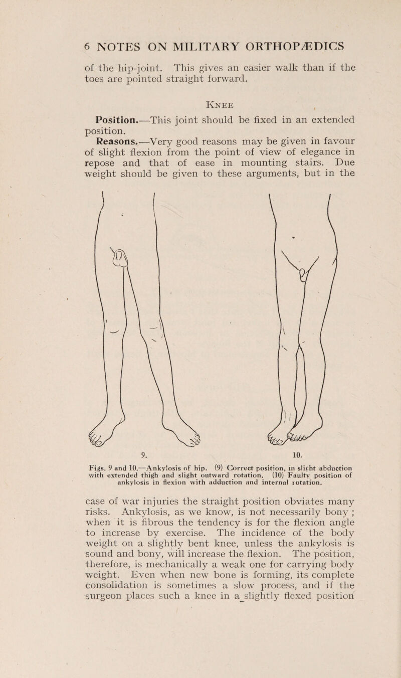 of the hip-joint. This gives an easier walk than if the toes are pointed straight forward. Knee Position.—This joint should be fixed in an extended position. Reasons.'—Very good reasons may be given in favour of slight flexion from the point of view of elegance in repose and that of ease in mounting stairs. Due weight should be given to these arguments, but in the Figs. 9 and 10.—Ankylosis of hip. (9) Correct position, in slight abduction with extended thigh and slight outward rotation. (10) Faulty position of ankylosis in flexion with adduction and internal lotation. case of war injuries the straight position obviates many risks. Ankylosis, as we know, is not necessarily bony ; when it is fibrous the tendency is for the flexion angle to increase by exercise. The incidence of the body weight on a slightly bent knee, unless the ankylosis is sound and bony, will increase the flexion. The position, therefore, is mechanically a weak one for carrying body weight. Even when new bone is forming, its complete consolidation is sometimes a slow process, and if the surgeon places such a knee in a_slightly flexed position