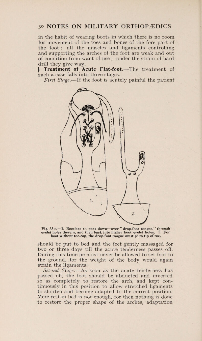 in the habit of wearing boots in which there is no room for movement of the toes and bones of the fore part of the foot : all the muscles and ligaments controlling and supporting the arches of the foot are weak and out of condition from want of use ; under the strain of hard drill they give way. ^ Treatment of Acute Flat-foot.—The treatment of such a case falls into three stages. First Stage.—If the foot is acutely painful the patient Fig. 33 b,—1. Bootlace to pass down—over “ drop-foot tongue,” through eyelet holes therein, and then back into higher boot eyelet holes. 2. For boot without toe-cap, the drop-foot tongue must go to tip of toe. should be put to bed and the feet gently massaged for two or three days till the acute tenderness passes off. During this time he must never be allowed to set foot to the ground, for the weight of the body would again strain the ligaments. Second Stage.—As soon as the acute tenderness has passed off, the foot should be abducted and inverted so as completely to restore the arch, and kept con¬ tinuously in this position to allow stretched ligaments to shorten and become adapted to the correct position. Mere rest in bed is not enough, for then nothing is done to restore the proper shape of the arches, adaptation