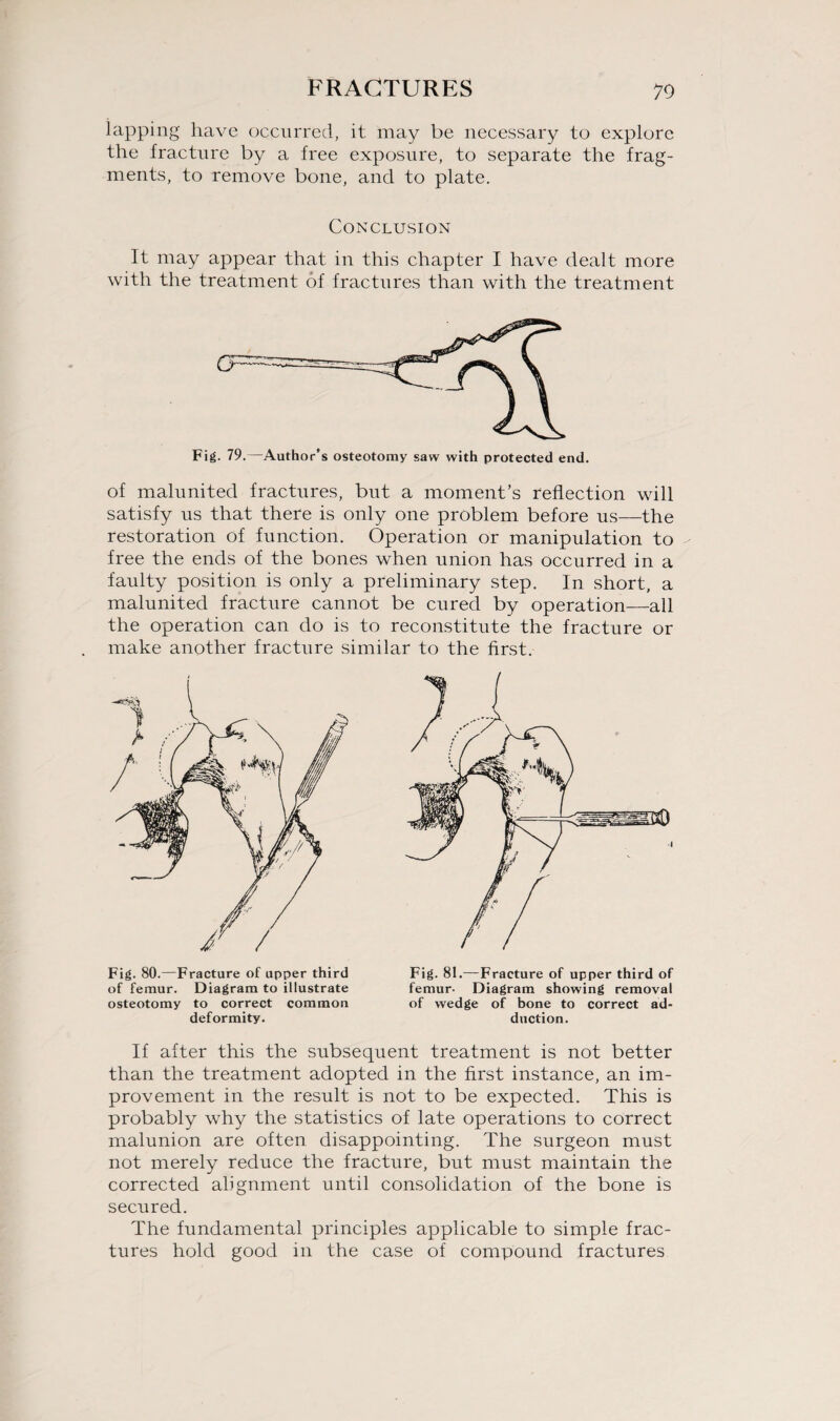 lapping have occurred, it may be necessary to explore the fracture by a free exposure, to separate the frag¬ ments, to remove bone, and to plate. Conclusion It may appear that in this chapter I have dealt more with the treatment of fractures than with the treatment Fig. 79.—Author’s osteotomy saw with protected end. of malunited fractures, but a moment’s reflection will satisfy us that there is only one problem before us—the restoration of function. Operation or manipulation to - free the ends of the bones when union has occurred in a faulty position is only a preliminary step. In short, a malunited fracture cannot be cured by operation—all the operation can do is to reconstitute the fracture or make another fracture similar to the first. / Fig. 80.—Fracture of upper third of femur. Diagram to illustrate osteotomy to correct common deformity. Fig. 81.—Fracture of upper third of femur- Diagram showing removal of wedge of bone to correct ad¬ duction. If after this the subsequent treatment is not better than the treatment adopted in the first instance, an im¬ provement in the result is not to be expected. This is probably why the statistics of late operations to correct malunion are often disappointing. The surgeon must not merely reduce the fracture, but must maintain the corrected alignment until consolidation of the bone is secured. The fundamental principles applicable to simple frac¬ tures hold good in the case of compound fractures