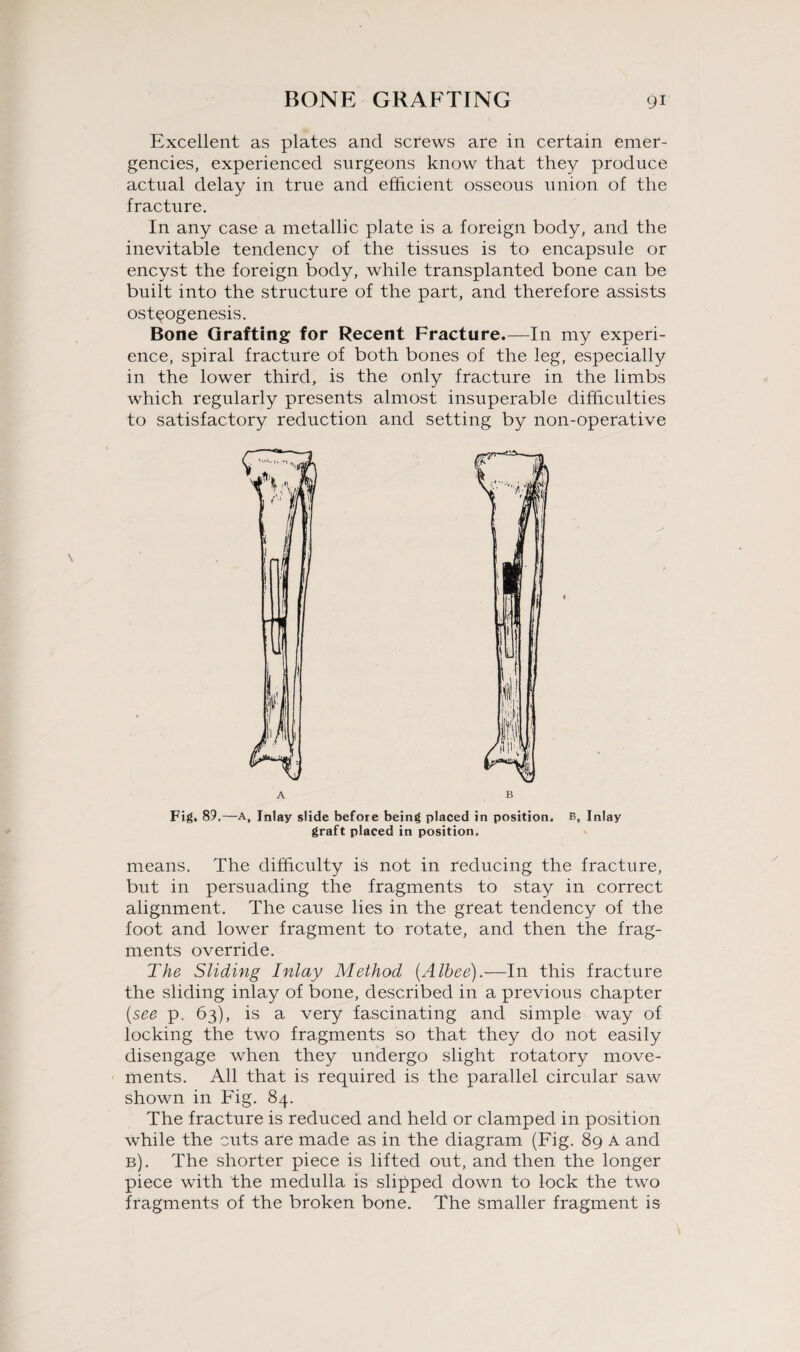 Excellent as plates and screws are in certain emer¬ gencies, experienced surgeons know that they produce actual delay in true and efficient osseous union of the fracture. In any case a metallic plate is a foreign body, and the inevitable tendency of the tissues is to encapsule or encyst the foreign body, while transplanted bone can be built into the structure of the part, and therefore assists osteogenesis. Bone Grafting for Recent Fracture.—In my experi¬ ence, spiral fracture of both bones of the leg, especially in the lower third, is the only fracture in the limbs which regularly presents almost insuperable difficulties to satisfactory reduction and setting by non-operative A B Fig. 89.—A, Inlay slide before being placed in position, b. Inlay graft placed in position. means. The difficulty is not in reducing the fracture, but in persuading the fragments to stay in correct alignment. The cause lies in the great tendency of the foot and lower fragment to rotate, and then the frag¬ ments override. The Sliding Inlay Method (Alhee).—In this fracture the sliding inlay of bone, described in a previous chapter [see p. 63), is a very fascinating and simple way of locking the two fragments so that they do not easily disengage when they undergo slight rotatory move¬ ments. All that is required is the parallel circular saw shown in Fig. 84. The fracture is reduced and held or clamped in position while the cuts are made as in the diagram (Fig. 89 a and b). The shorter piece is lifted out, and then the longer piece with the medulla is slipped down to lock the two fragments of the broken bone. The Smaller fragment is