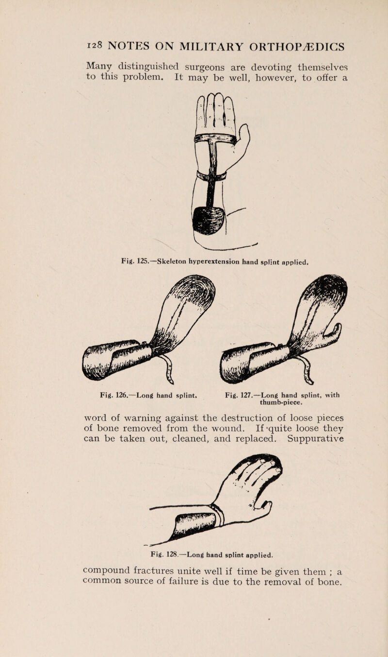 Many distinguished surgeons are devoting themselves to this problem. It may be well, however, to offer a Fig. 125.—Skeleton hyperextension hand splint applied. Fig. 126.—Long hand splint. Fig. 127.—Long hand splint, with thumb-piece. word of warning against the destruction of loose pieces of bone removed from the wound. If'quite loose they can be taken out, cleaned, and replaced. Suppurative Fig. 128,—Long hand splint applied. compound fractures unite well if time be given them ; a common source of failure is due to the removal of bone.