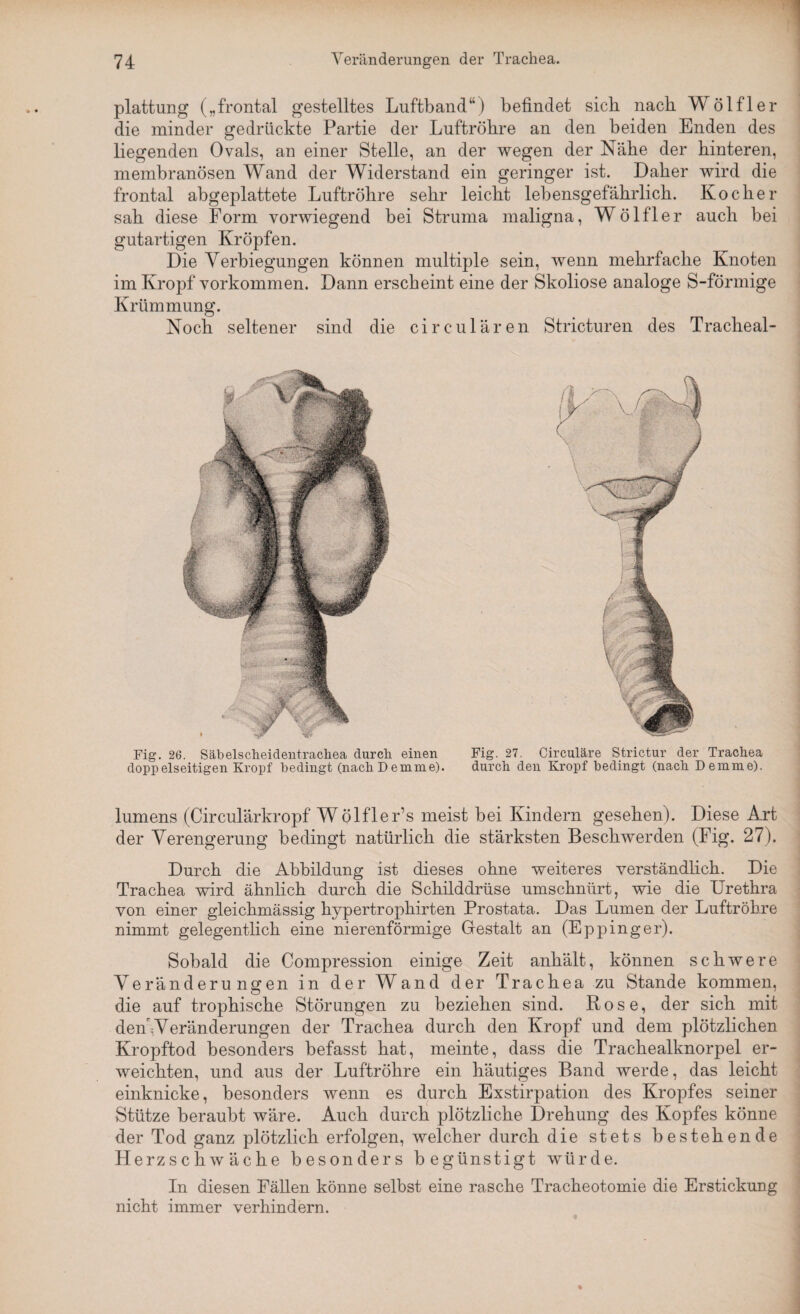 plattung („frontal gestelltes Luftband“) befindet sieb nach Wölfl er die minder gedrückte Partie der Luftröhre an den beiden Enden des liegenden Ovals, an einer Stelle, an der wegen der Nähe der hinteren, membranösen Wand der Widerstand ein geringer ist. Daher wird die frontal abgeplattete Luftröhre sehr leicht lebensgefährlich. Kocher sah diese Form vorwiegend bei Struma maligna, Wölfl er auch bei gutartigen Kröpfen. Die Verbiegungen können multiple sein, wenn mehrfache Knoten im Kropf Vorkommen. Dann erscheint eine der Skoliose analoge S-förmige Krümmung. Noch seltener sind die circularen Stricturen des Tracheal- Fig. 26. Säbelscheidentracliea durch einen doppelseitigen Kropf bedingt (nach D emme). Fig. 27. Circuläre Strictur der Trachea durch den Kropf bedingt (nach Demme). lumens (Circulärkropf Wölfler’s meist bei Kindern gesehen). Diese Art der Verengerung bedingt natürlich die stärksten Beschwerden (Fig. 27). Durch die Abbildung ist dieses ohne weiteres verständlich. Die Trachea wird ähnlich durch die Schilddrüse umschnürt, wie die Urethra von einer gleichruässig hypertrophirten Prostata. Das Lumen der Luftröhre nimmt gelegentlich eine nierenförmige Gestalt an (Eppinger). Sobald die Compression einige Zeit anhält, können schwere Veränderungen in der Wand der Trachea zu Stande kommen, die auf trophische Störungen zu beziehen sind. Rose, der sich mit denWeränderungen der Trachea durch den Kropf und dem plötzlichen Kropftod besonders befasst hat, meinte, dass die Trachealknorpel er¬ weichten, und aus der Luftröhre ein häutiges Band werde, das leicht einknicke, besonders wenn es durch Exstirpation des Kropfes seiner Stütze beraubt wäre. Auch durch plötzliche Drehung des Kopfes könne der Tod ganz plötzlich erfolgen, welcher durch die stets bestehende H erzschwäche besonders begünstigt würde. In diesen Fällen könne selbst eine rasche Tracheotomie die Erstickung nicht immer verhindern.
