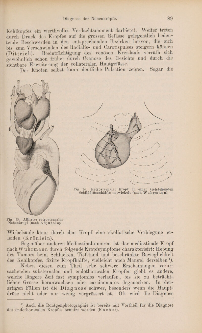 Kehlkopfes ein werthvolles Verdachtsmoment darbietet. Weiter treten durch Druck des Kropfes auf die grossen Gefässe gelegentlich bedeu¬ tende Beschwerden in den entsprechenden Bezirken hervor, die sich bis zum Verschwinden des Radialis- und Carotispulses steigern können (Dittrich). Beeinträchtigung des venösen Kreislaufs verräth sich o-ewöhnlich schon früher durch Cyanose des Gesichts und durch die sichtbare Erweiterung der collateralen Hautgefässe. Der Knoten selbst kann deutliche Pulsation zeigen. Sogar die Fig. 33. Alliirter retrosternaler Nebenkropf (nach Adjutolo). Wirbelsäule kann durch den Kropf eine skoliotische Verbiegung er¬ leiden (Krönlein). Gegenüber anderen Mediastinaltumoren ist der mediastinale Kropf nachWuhrmann durch folgende Kropfsymptome charakterisirt: Hebung des Tumors beim Schlucken, Tiefstand und beschränkte Beweglichkeit des Kehlkopfes, fixirte Kropfhälfte, vielleicht auch Mangel derselben 1). Neben diesen zum Theil sehr schwere Erscheinungen verur¬ sachenden substernalen und endothoracalen Kröpfen giebt es andere, welche längere Zeit fast symptomlos verlaufen, bis sie zu beträcht¬ licher Grösse heranwachsen oder carcinomatös degeneriren. In der¬ artigen Fällen ist die Diagnose schwer, besonders wenn die Haupt¬ drüse nicht oder nur wenig vergrössert ist. Oft wird die Diagnose 9 Auch die Röntgenphotographie ist bereits mit Yortheil für die Diagnose des endothoracalen Kropfes benutzt worden (Kocher). Fig. 34. Retrosternaler Kropf in einer tiefstebenden Schilddrüsenhälfte entwickelt (nach Wuhrmann).