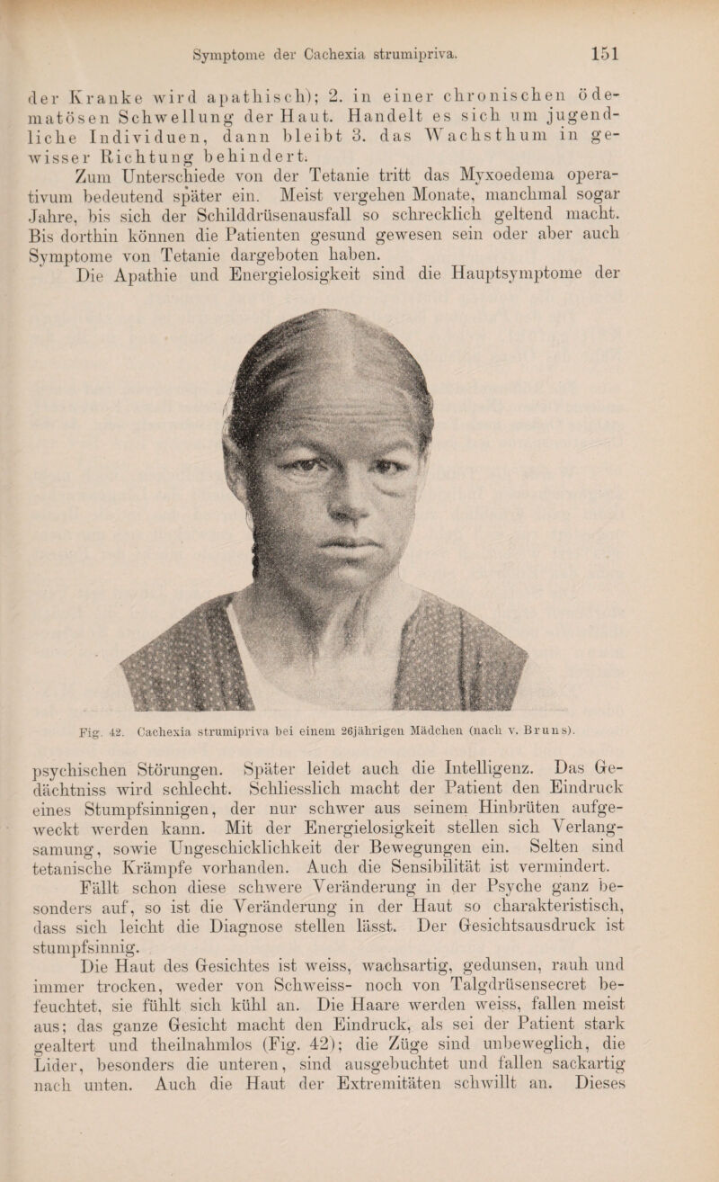 der Kranke wird apathisch); 2. in einer chronischen öde- matösen Schwellung der Haut. Handelt es sich um jugend¬ liche Individuen, dann bleibt 3. das Wachst hum in ge¬ wisser Richtung behindert. Zum Unterschiede von der Tetanie tritt das Myxoedema opera- tivum bedeutend später ein. Meist vergehen Monate, manchmal sogar Jahre, bis sich der Schilddrüsenausfall so schrecklich geltend macht. Bis dorthin können die Patienten gesund gewesen sein oder aber auch Symptome von Tetanie dargeboten haben. Die Apathie und Energielosigkeit sind die Hauptsymptome der psychischen Störungen. Später leidet auch die Intelligenz. Das Ge- dächtniss wird schlecht. Schliesslich macht der Patient den Eindruck eines Stumpfsinnigen, der nur schwer aus seinem Hinbrüten aufge¬ weckt werden kann. Mit der Energielosigkeit stellen sich Verlang¬ samung, sowie Ungeschicklichkeit der Bewegungen ein. Selten sind tetanische Krämpfe vorhanden. Auch die Sensibilität ist vermindert. Fällt schon diese schwere Veränderung in der Psyche ganz be¬ sonders auf, so ist die Veränderung in der Haut so charakteristisch, dass sich leicht die Diagnose stellen lässt. Der Gesichtsausdruck ist stumpfsinnig. Die Haut des Gesichtes ist weiss, wachsartig, gedunsen, rauh und immer trocken, weder von Schweiss- noch von Talgdrüsensecret be¬ feuchtet, sie fühlt sich kühl an. Die Haare werden weiss, fällen meist aus; das ganze Gesicht macht den Eindruck, als sei der Patient stark gealtert und theilnahmlos (Fig. 42); die Züge sind unbeweglich, die Lider, besonders die unteren, sind ausgebuchtet und fällen sackartig nach unten. Auch die Haut der Extremitäten schwillt an. Dieses