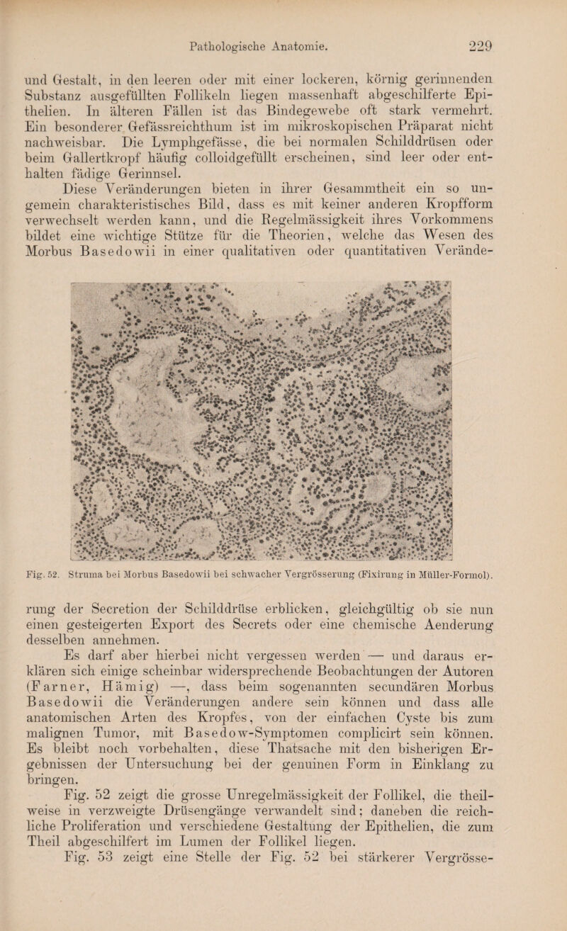 und Gestalt, in den leeren oder mit einer lockeren, körnig gerinnenden Substanz ausgefüllten Follikeln liegen massenhaft abgeschilferte Epi- thelien. In älteren Fällen ist das Bindegewebe oft stark vermehrt. Ein besonderer Gefässreichthum ist im mikroskopischen Präparat nicht nachweisbar. Die Lymphgefässe, die bei normalen Schilddrüsen oder beim Gallertkropf häufig colloidgefüllt erscheinen, sind leer oder ent¬ halten fädige Gerinnsel. Diese Veränderungen bieten in ihrer Gesammtheit ein so un- gemein charakteristisches Bild, dass es mit keiner anderen Kropfform verwechselt werden kann, und die Regelmässigkeit ihres Vorkommens bildet eine wichtige Stütze für die Theorien, welche das Wesen des Morbus Basedowii in einer qualitativen oder quantitativen Verände- Fig. 52. Struma bei Morbus Basedowii bei schwacher Vergrösserung (Fixirung in Müller-Formol). rung der Secretion der Schilddrüse erblicken, gleichgültig ob sie nun einen gesteigerten Export des Secrets oder eine chemische Aenderung desselben annehmen. Es darf aber hierbei nicht vergessen werden — und daraus er¬ klären sich einige scheinbar widersprechende Beobachtungen der Autoren (Farner, Hämig) —, dass beim sogenannten seeundären Morbus Basedowii die Veränderungen andere sein können und dass alle anatomischen Arten des Kropfes, von der einfachen Cyste bis zum malignen Tumor, mit Basedow-Symptomen complicirt sein können. Es bleibt noch Vorbehalten, diese Thatsache mit den bisherigen Er¬ gebnissen der Untersuchung bei der genuinen Form in Einklang zu bringen. Fig. 52 zeigt die grosse Unregelmässigkeit der Follikel, die theil- weise in verzweigte Drüsengänge verwandelt sind; daneben die reich¬ liche Proliferation und verschiedene Gestaltung der Epithelien, die zum Theil abgeschilfert im Lumen der Follikel liegen. Fig. 53 zeigt eine Stelle der Fig. 52 bei stärkerer Vergrösse-