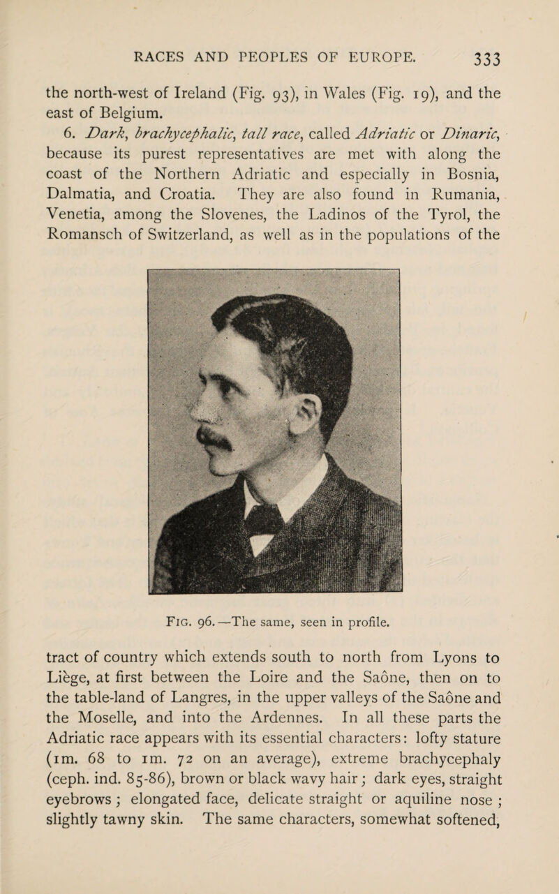 the north-west of Ireland (Fig. 93), in Wales (Fig. 19), and the east of Belgium. 6. Dark, brachy cephalic, tall race, called Adriatic or Dinaric, because its purest representatives are met with along the coast of the Northern Adriatic and especially in Bosnia, Dalmatia, and Croatia. They are also found in Rumania, Venetia, among the Slovenes, the Ladinos of the Tyrol, the Romansch of Switzerland, as well as in the populations of the Fig. 96.—The same, seen in profile. tract of country which extends south to north from Lyons to Liege, at first between the Loire and the Saone, then on to the table-land of Langres, in the upper valleys of the Saone and the Moselle, and into the Ardennes. In all these parts the Adriatic race appears with its essential characters: lofty stature (im. 68 to im. 72 on an average), extreme brachycephaly (ceph. ind. 85-86), brown or black wavy hair; dark eyes, straight eyebrows ; elongated face, delicate straight or aquiline nose ; slightly tawny skin. The same characters, somewhat softened,