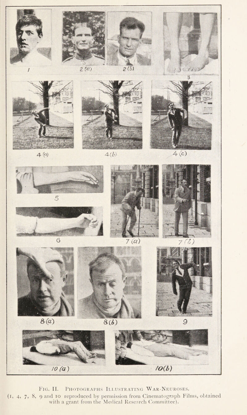 8(a) io fa ) f«) 7 («) 8(*) mb) Fig. II. Photographs Illustrating War-Neuroses. (i, 4, 7, 8, 9 and io reproduced by permission from Cinematograph Films, obtained with a grant from the Medical Research Committee).
