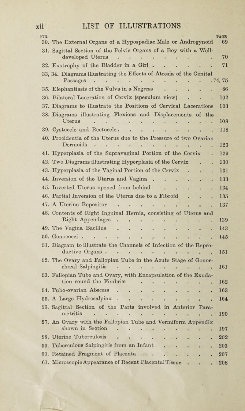 • • Fig. page 30. The External Organs of a Hypospadiac Male or Androgynoid 69 31. Sagittal Section of the Pelvic Organs of a Boy with a Well- developed Uterus.70 32. Exstrophy of the Bladder in a Girl.71 33. 34. Diagrams illustrating the Effects of Atresia of the Genital Passages.74, 75 35. Elephantiasis of the Vulva in a Negress.86 36. Bilateral Laceration of Cervix (speculum view) . . .102 37. Diagrams to illustrate the Positions of Cervical Lacerations 103 38. Diagrams illustrating Flexions and Displacements of the Uterus. 108 39. Cystocele and Rectocele.118 40. Procidentia of the Uterus due to the Pressure of two Ovarian Dermoids.123 41. Hyperplasia of the Supravaginal Portion of the Cervix . 129 42. Two Diagrams illustrating Hyperplasia of the Cervix . .130 43. Hyperplasia of the Vaginal Portion of the Cervix . . . 131 44. Inversion of the Uterus and Vagina.133 45. Inverted Uterus opened from behind.134 46. Partial Inversion of the Uterus due to a Fibroid . . .135 47. A Uterine Repositor.137 48. Contents of Right Inguinal Hernia, consisting of Uterus and Right Appendages.139 49. The Vagina Bacillus . . . . . . . . .143 50. Gonococci.,.145 51. Diagram to illustrate the Channels of Infection of the Repro¬ ductive Organs.151 52. The Ovary and Fallopian Tube in the Acute Stage of Gonor¬ rhoeal Salpingitis.161 53. Fallopian Tube and Ovary, with Encapsulation of the Exuda¬ tion round the Fimbriae.162 54. Tubo-ovarian Abscess.163 55. A Large Hydrosalpinx.164 56. Sagittal Section of the Parts involved in Anterior Para¬ metritis .190 57. An Ovary with the Fallopian Tube and Vermiform Appendix shown in Section . . 197 58. Uterine Tuberculosis.202 59. Tuberculous Salpingitis from an Infant.203 60. Retained Fragment of Placenta.207 61. Microscopic Appearance of Recent Placental Tissue . . . 208