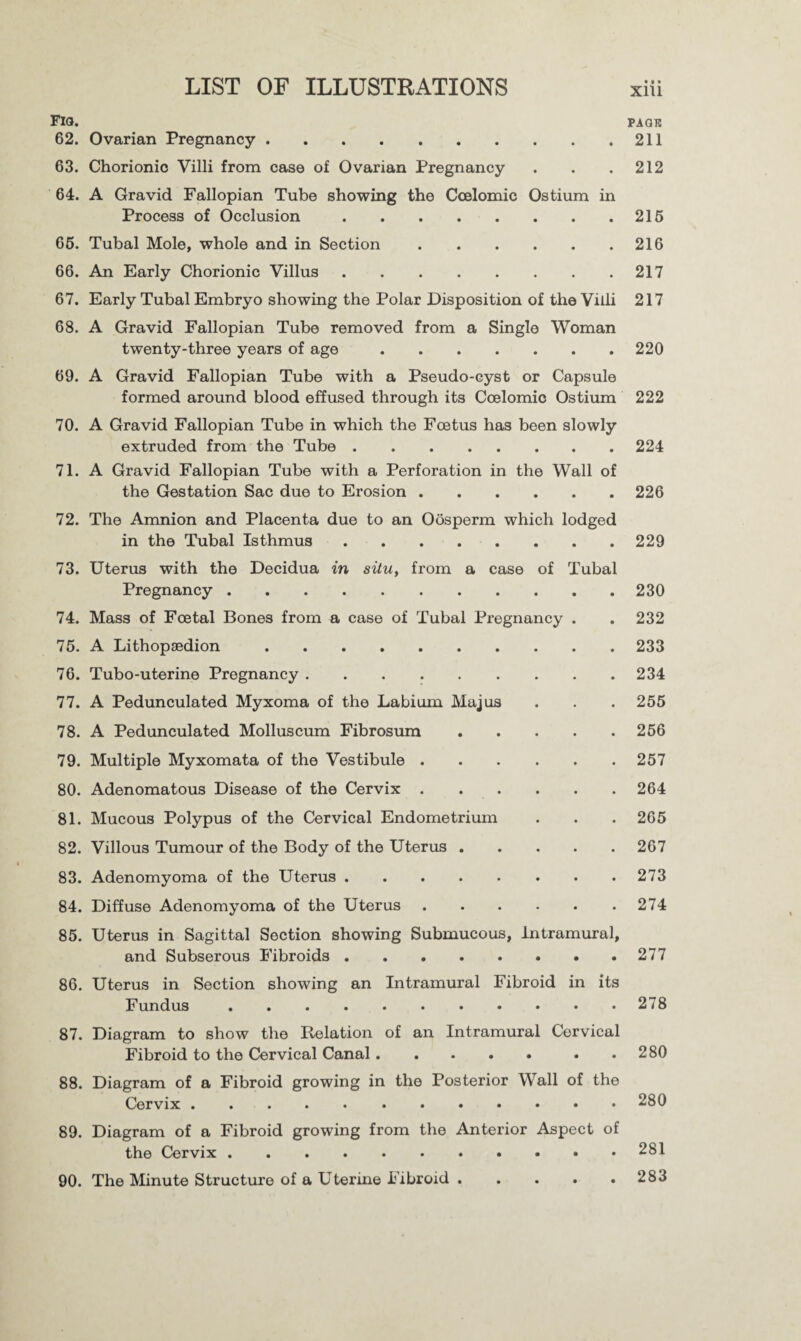 Flo. 62. Ovarian Pregnancy. 63. Chorionic Villi from case of Ovarian Pregnancy 64. A Gravid Fallopian Tube showing the Ccelomic Ostium in Process of Occlusion. 66. Tubal Mole, whole and in Section. 66. An Early Chorionic Villus. 67. Early Tubal Embryo showing the Polar Disposition of the Villi 68. A Gravid Fallopian Tube removed from a Single Woman twenty-three years of age. 69. A Gravid Fallopian Tube with a Pseudo-cyst or Capsule formed around blood effused through its Ccelomic Ostium 70. A Gravid Fallopian Tube in which the Foetus has been slowly extruded from the Tube. 71. A Gravid Fallopian Tube with a Perforation in the Wall of the Gestation Sac due to Erosion. 72. The Amnion and Placenta due to an Oosperm which lodged in the Tubal Isthmus. 73. Uterus with the Decidua in situ, from a case of Tubal Pregnancy . 74. Mass of Foetal Bones from a case of Tubal Pregnancy . 75. A Lithopaedion. 76. Tubo-uterine Pregnancy. 77. A Pedunculated Myxoma of the Labium Majus 78. A Pedunculated Molluscum Fibrosum. 79. Multiple Myxomata of the Vestibule. 80. Adenomatous Disease of the Cervix. 81. Mucous Polypus of the Cervical Endometrium 82. Villous Tumour of the Body of the Uterus. 83. Adenomyoma of the Uterus. 84. Diffuse Adenomyoma of the Uterus. 85. Uterus in Sagittal Section showing Submucous, Intramural, and Subserous Fibroids. 86. Uterus in Section showing an Intramural Fibroid in its Fundus . 87. Diagram to show the Relation of an Intramural Cervical Fibroid to the Cervical Canal.. 88. Diagram of a Fibroid growing in the Posterior Wall of the Cervix. 89. Diagram of a Fibroid growing from the Anterior Aspect of the Cervix. 90. The Minute Structure of a Uterine Fibroid. PACK 211 212 215 216 217 217 220 222 224 226 229 230 232 233 234 255 256 257 264 265 267 273 274 277 278 280 280 281 283