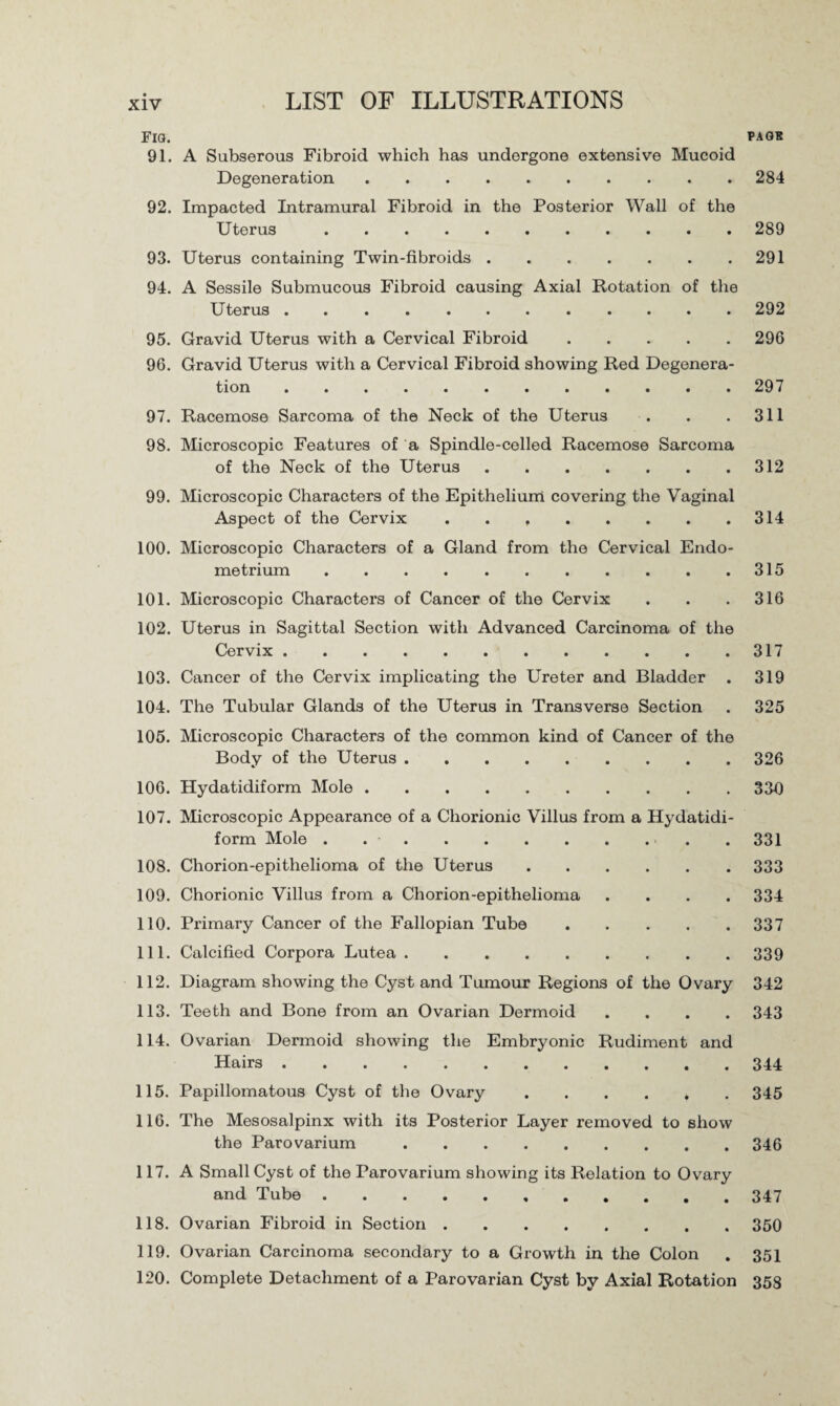 Fig. *agk 91. A Subserous Fibroid which has undergone extensive Mucoid Degeneration.284 92. Impacted Intramural Fibroid in the Posterior Wall of the Uterus.289 93. Uterus containing Twin-fibroids.291 94. A Sessile Submucous Fibroid causing Axial Rotation of the Uterus.292 95. Gravid Uterus with a Cervical Fibroid.296 96. Gravid Uterus with a Cervical Fibroid showing Red Degenera¬ tion .297 97. Racemose Sarcoma of the Neck of the Uterus . . .311 98. Microscopic Features of a Spindle-celled Racemose Sarcoma of the Neck of the Uterus.312 99. Microscopic Characters of the Epithelium covering the Vaginal Aspect of the Cervix . . 314 100. Microscopic Characters of a Gland from the Cervical Endo¬ metrium .315 101. Microscopic Characters of Cancer of the Cervix . . . 316 102. Uterus in Sagittal Section with Advanced Carcinoma of the Cervix.317 103. Cancer of the Cervix implicating the Ureter and Bladder . 319 104. The Tubular Glands of the Uterus in Transverse Section . 325 105. Microscopic Characters of the common kind of Cancer of the Body of the Uterus.326 106. Hydatidiform Mole.330 107. Microscopic Appearance of a Chorionic Villus from a Hydatidi¬ form Mole . ... . 331 108. Chorion-epithelioma of the Uterus.333 109. Chorionic Villus from a Chorion-epithelioma .... 334 110. Primary Cancer of the Fallopian Tube.337 111. Calcified Corpora Lutea.339 112. Diagram showing the Cyst and Tumour Regions of the Ovary 342 113. Teeth and Bone from an Ovarian Dermoid .... 343 114. Ovarian Dermoid showing the Embryonic Rudiment and Hairs.344 115. Papillomatous Cyst of the Ovary.345 116. The Mesosalpinx with its Posterior Layer removed to show the Parovarium.346 117. A Small Cyst of the Parovarium showing its Relation to Ovary and Tube.347 118. Ovarian Fibroid in Section.350 119. Ovarian Carcinoma secondary to a Growth in the Colon . 351 120. Complete Detachment of a Parovarian Cyst by Axial Rotation 353