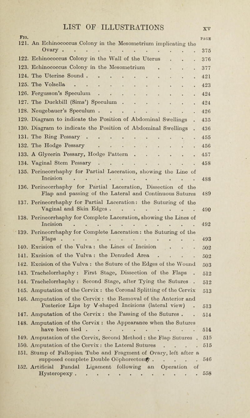 Fig. 121. An Echinococcus Colony in the Mesometrium implicating the Ovary. 122. Echinococcus Colony in the Wall of the Uterus 123. Echinococcus Colony in the Mesometrium .... 124. The Uterine Sound. 125. The Volsella. 126. Fergusson’s Speculum. 127. The Duckbill (Sims’) Speculum. 128. Neugebauer’s Speculum. 129. Diagram to indicate the Position of Abdominal Swellings 130. Diagram to indicate the Position of Abdominal Swellings . 131. The Ping Pessary. 132. The Hodge Pessary. 133. A Glycerin Pessary, Hodge Pattern. 134. Vaginal Stem Pessary. 135. Perineorrhaphy for Partial Laceration, showing the Line of Incision. 136. Perineorrhaphy for Partial Laceration, Dissection of the Flap and passing of the Lateral and Continuous Sutures 137. Perineorrhaphy for Partial Laceration: the Suturing of the Vaginal and Skin Edges. 138. Perineorrhaphy for Complete Laceration, showing the Lines of Incision. 139. Perineorrhaphy for Complete Laceration: the Suturing of the Flaps. 140. Excision of the Vulva : the Lines of Incision 141. Excision of the Vulva : the Denuded Area .... 142. Excision of the Vulva : the Suture of the Edges of the Wound 143. Trachelorrhaphy : First Stage, Dissection of the Flaps 144. Trachelorrhaphy : Second Stage, after Tying the Sutures . 145. Amputation of the Cervix : the Coronal Splitting of the Cervix 146. Amputation of the Cervix : the Removal of the Anterior and Posterior Lips by V-shaped Incisions (lateral view) 147. Amputation of the Cervix : the Passing of the Sutures . 148. Amputation of the Cervix : the Appearance when the Sutures have been tied. 149. Amputation of the Cervix, Second Method : the Flap Sutures . 150. Amputation of the Cervix : the Lateral Sutures .... 151. Stump of Fallopian Tube and Fragment of Ovary, left after a supposed complete Double Oophorectomy. 152. Artificial Fundal Ligament following an Operation of Hysteropexy. PAGE 375 376 377 421 423 424 424 426 435 436 455 456 457 458 488 489 490 492 493 502 502 503 512 512 513 513 514 514 515 515 546 558