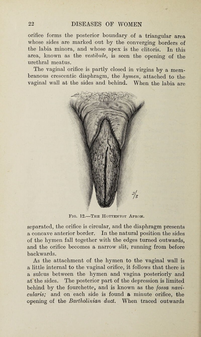 orifice forms the posterior boundary of a triangular area whose sides are marked out by the converging borders of the labia minora, and whose apex is the clitoris. In this area, known as the vestibule, is seen the opening of the urethral meatus. The vaginal orifice is partly closed in virgins by a mem¬ branous crescentic diaphragm, the hymen, attached to the vaginal wall at the sides and behind. When the labia are Fig. 12.—The Hottentot Apron. separated, the orifice is circular, and the diaphragm presents a concave anterior border. In the natural position the sides of the hymen fall together with the edges turned outwards, and the orifice becomes a narrow slit, running from before backwards. As the attachment of the hymen to the vaginal wall is a little internal to the vaginal orifice, it follows that there is a sulcus between the hymen and vagina posteriorly and at the sides. The posterior part of the depression is limited behind by the fourchette, and is known as the fossa navi- cularis; and on each side is found a minute orifice, the opening of the Bartholinian duct. When traced outwards