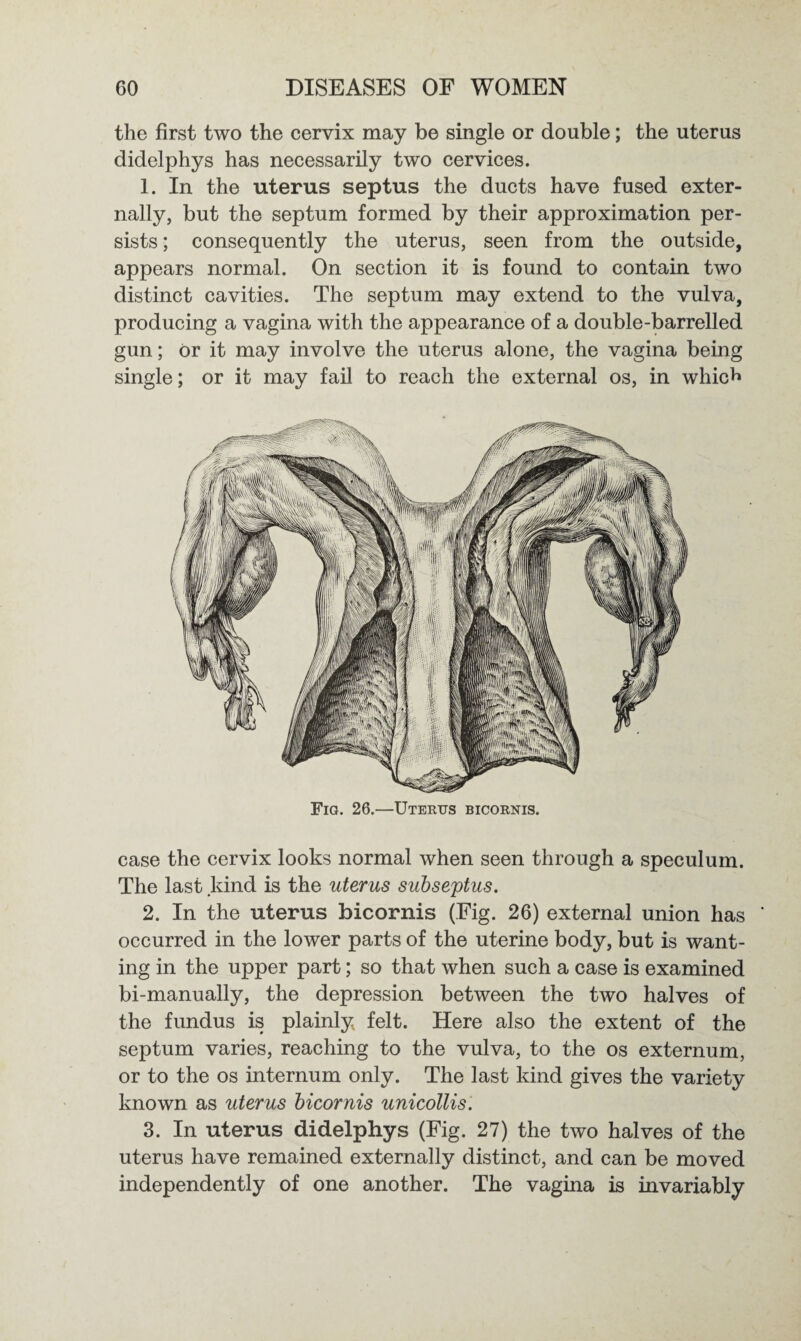 the first two the cervix may be single or double; the uterus didelphys has necessarily two cervices. 1. In the uterus septus the ducts have fused exter¬ nally, but the septum formed by their approximation per¬ sists ; consequently the uterus, seen from the outside, appears normal. On section it is found to contain two distinct cavities. The septum may extend to the vulva, producing a vagina with the appearance of a double-barrelled gun; or it may involve the uterus alone, the vagina being single; or it may fail to reach the external os, in which Fig. 26.—Uterus bicornis. case the cervix looks normal when seen through a speculum. The last kind is the uterus subseptus. 2. In the uterus bicornis (Fig. 26) external union has ' occurred in the lower parts of the uterine body, but is want¬ ing in the upper part; so that when such a case is examined bi-manually, the depression between the two halves of the fundus is plainly felt. Here also the extent of the septum varies, reaching to the vulva, to the os externum, or to the os internum only. The last kind gives the variety known as uterus bicornis unicollis. 3. In uterus didelphys (Fig. 27) the two halves of the uterus have remained externally distinct, and can be moved independently of one another. The vagina is invariably