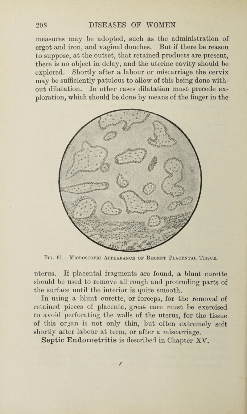 measures may be adopted, such as the administration of ergot and iron, and vaginal douches. But if there be reason to suppose, at the outset, that retained products are present, there is no object in delay, and the uterine cavity should be explored. Shortly after a labour or miscarriage the cervix may be sufficiently patulous to allow of this being done with¬ out dilatation. In other cases dilatation must precede ex¬ ploration, which should be done by means of the finger in the Fig. Gl.—Microscopic Appearance of Recent Placental Tissue. uterus. If placental fragments are found, a blunt curette should be used to remove all rough and protruding parts of the surface until the interior is quite smooth. In using a blunt curette, or forceps, for the removal of retained pieces of placenta, great care must be exercised to avoid perforating the walls of the uterus, for the tissue of this organ is not only thin, but often extremely soft shortly after labour at term, or after a miscarriage. Septic Endometritis is described in Chapter XV. /