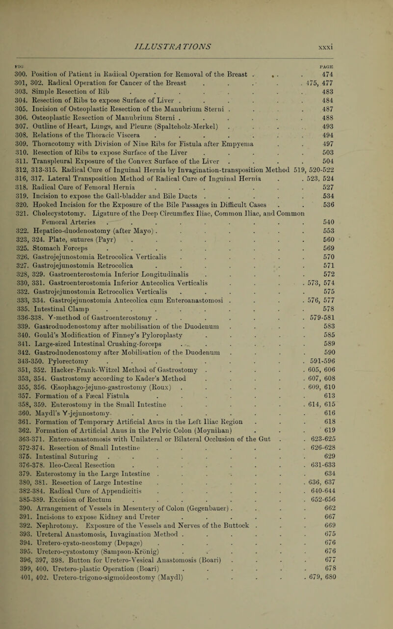 FIG PAGE 300. Position of Patient in Radical Operation for Removal of the Breast . , . . 474 301,302. Radical Operation for Cancer of the Breast . . .■ . . 475, 477 303. Simple Resection of Bib ........ 483 304. Resection of Ribs to expose Surface of Liver ...... 484 305. Incision of Osteoplastic Resection of the Manubrium Sterni .... 487 306. Osteoplastic Resection of Manubrium Sterni ...... 488 307. Outline of Heart, Lungs, and Pleurae (Spalteholz-Merkel) .... 493 308. Relations of the Thoracic Viscera ....... 494 309. Thoracotomy with Division of Niue Ribs for Fistula after Empyema . . 497 310. Resection of Ribs to expose Surface of the Liver ..... 503 311. Transpleural Exposure of the Convex Surface of the Liver .... 504 312. 313-315. Radical Cure of Inguinal Hernia by Invagination-transposition Method 519, 520-522 316, 317. Lateral Transposition Method of Radical Cure of Inguinal Hernia . . 523, 524 318. Radical Cure of Femoral Hernia ....... 527 319. Incision to expose the Gall-bladder and Bile Ducts ..... 534 320. Hooked Incision for the Exposure of the Bile Passages in Difficult Cases . . 536 321. Cholecystotomy. Ligature of the Deep Circumflex Iliac, Common Iliac, and Common Femoral Arteries ......... 540 322. Hepatico-duodenostomy (after Mayo)....... 553 323. 324. Plate, sutures (Payr) ........ 560 325. Stomach Forceps ......... 569 326. Gastrojejunostomia Retrocolica Yerticalis ...... 570 327. Gastrojejunostomia Retrocolica ....... 571 328. 329. Gastroenterostomia Inferior Longitudinalis ..... 572 330, 331. Gastroenterostomia Inferior Antecolica Verticalis .... 573, 574 332. Gastrojejunostomia Retrocolica Verticalis ...... 575 333, 334. Gastrojejunostomia Antecolica cum Enteroanastomosi .... 576, 577 335. Intestinal Clamp ......... 578 336-338. Y-method of Gastroenterostomy ....... 579-581 339. Gastroduodenostomy after mobilisation of the Duodenum .... 583 340. Gould’s Modification of Finney’s Pyloroplasty ..... 585 341. Large-sized Intestinal Crushing-forceps . . . . ... . 589 342. Gastroduodenostomy after Mobilisation of the Duodenum .... 590 343-350. Pylorectomy . . . ' . . . . . . 591-596 351, 352. Hacker-Frank-Witzel Method of Gastrostomy ..... 605, 606 353, 354. Gastrostomy according to Kader’s Method ..... 607, 608 355, 356. (Esophago-jejuno-gastrostomy (Roux) ...... 609, 610 357. Formation of a Faecal Fistula ....... 613 358, 359. Enterostomy in the Small Intestine ...... 614, 615 360. Maydl’s Y-jejunostomy ........ 616 361. Formation of Temporary Artificial Anus in the Left Iliac Region . . . 618 362. Formation of Artificial Anus in the Pelvic Colon (Moynihan) . . . 619 363-371. Entero-anastomosis with Unilateral or Bilateral Occlusion of the Gut . . 623-625 372-374. Resection of Small Intestine ....... 626-628 375. Intestinal Suturing ......... 629 376-378. lleo-Ctecal Resection ........ 631-633 379. Enterostomy in the Large Intestine ....... 634 380, 381. Resection of Large Intestine ....... 636, 637 382-384. Radical Cure of Appendicitis ....... 640-644 385-389. Excision of Rectum ........ 652-656 390. Arrangement of Vessels in Mesentery of Colon (Gegenbauer) .... 662 391. Incisions to expose Kidney and Ureter ...... 667 392. Nephrotomy. Exposure of the Vessels and Nerves of the Buttock . . . 669 393. Ureteral Anastomosis, Invagination Method . . . . . .675 394. Uretero-eysto-neostomy (Depage) . . . . - - .676 395. Uretero-cystostomy (Sampson-Krönig) . . . . . .676 396. 397, 398. Button for Uretero-Vesical Anastomosis (Boari) .... 677 399, 400. Uretero-plastic Operation (Boari) ...... 678 401, 402. Uretero-trigono-sigmoideostomy (Maydl) ..... 679, 680