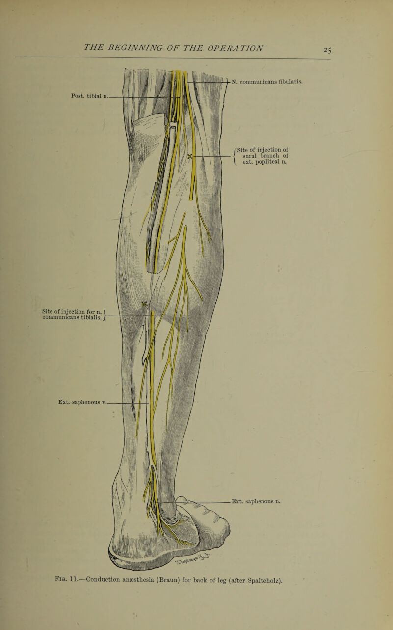 Fig. 11.—Conduction anaesthesia (Braun) for back of leg (after Spalteholz).