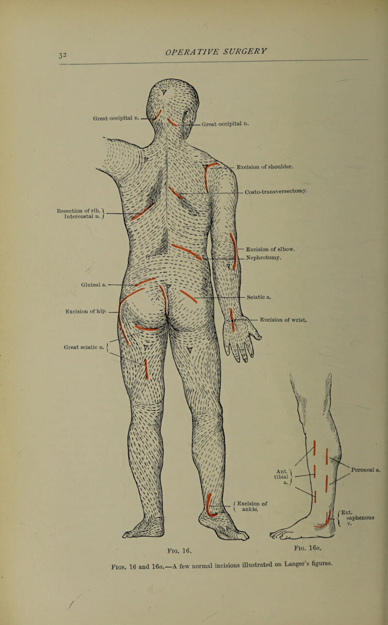 Great occipital n. Great occipital n. Kesection of rib. Intercostal Gluteal a. Excision of hip. Great sciatic n. I Excision of shoulder. Costo-transversectomy. Excision of elbow. Nephrotomy. Sciatic a. Excision of wrist. f Excision of 1 ankle. Peroneal (Ext. 1 saphenous Fia. 16. Fig. 16a.