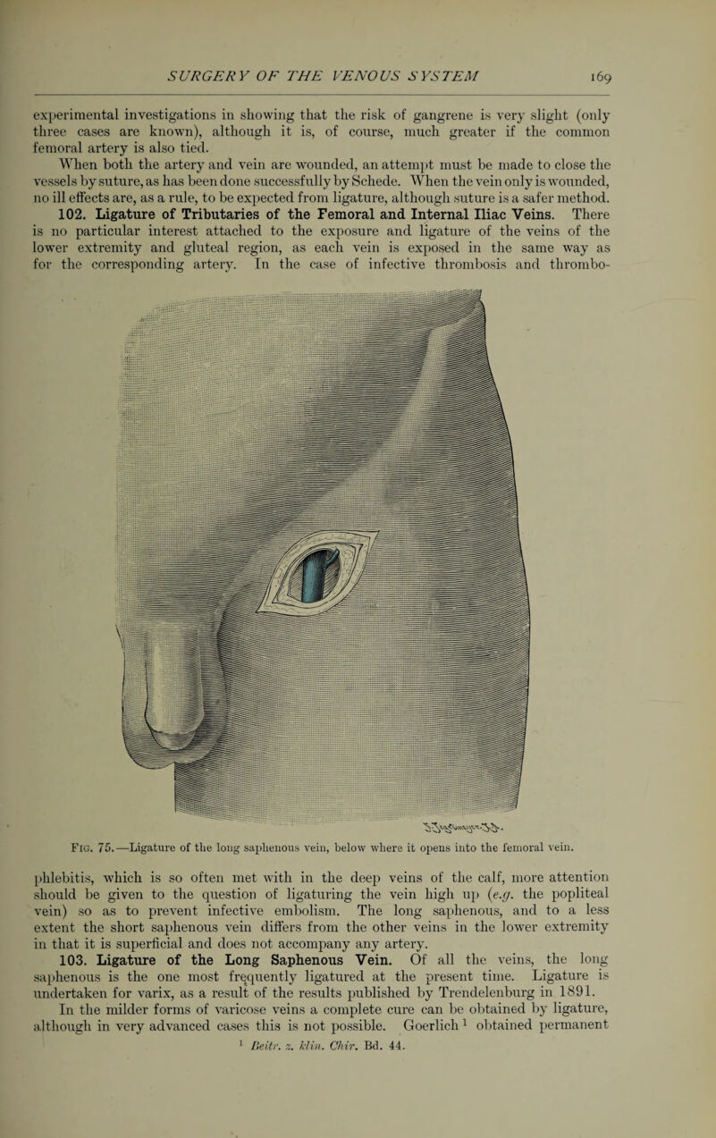 experimental investigations in showing that the risk of gangrene is very slight (only three cases are known), although it is, of course, much greater if the common femoral artery is also tied. When both the artery and vein are wounded, an attempt must be made to close the vessels by suture, as has been done successfully by Schede. When the vein only is wounded, no ill effects are, as a rule, to be expected from ligature, although suture is a safer method. 102. Ligature of Tributaries of the Femoral and Internal Iliac Veins. There is no particular interest attached to the exposure and ligature of the veins of the lower extremity and gluteal region, as each vein is exposed in the same way as for the corresponding artery. In the case of infective thrombosis and thrombo- Fig. 75.—Ligature of the long saphenous vein, below where it opens into the femoral vein. phlebitis, which is so often met with in the deep veins of the calf, more attention should be given to the question of ligaturing the vein high up (e.g. the popliteal vein) so as to prevent infective embolism. The long saphenous, and to a less extent the short saphenous vein differs from the other veins in the lower extremity in that it is superficial and does not accompany any artery. 103. Ligature of the Long Saphenous Vein. Of all the veins, the long saphenous is the one most frequently ligatured at the present time. Ligature is undertaken for varix, as a result of the results published by Trendelenburg in 1891. In the milder forms of varicose veins a complete cure can be obtained by ligature, although in very advanced cases this is not possible. Goerlich 1 obtained permanent 1 Beitr. z. Min. Chir. Bd. 44.