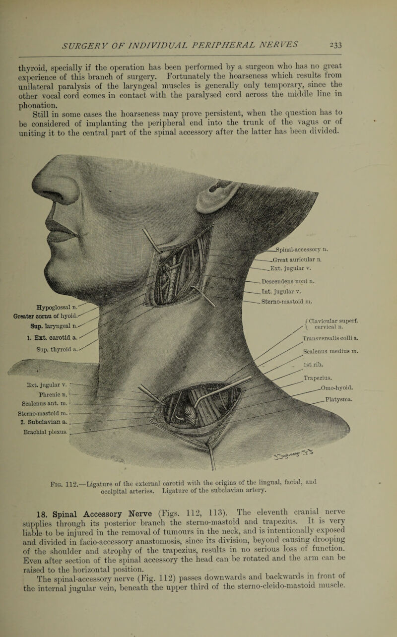 thyroid, specially if the operation has been performed by a surgeon who has no great experience of this branch of surgery. Fortunately the hoarseness which results from unilateral paralysis of the laryngeal muscles is generally only temporary, since the other vocal cord comes in contact with the paralysed cord across the middle line in phonation. Still in some cases the hoarseness may prove persistent, when the question has to be considered of implanting the peripheral end into the trunk of the vagus or of uniting it to the central part of the spinal accessory after the latter has been divided. Hypoglossal n. Greater cornu of Sup. laryngeal 1. Ext. carotid, a Sup. thyroid a rl-accessory n. auricular n. jugular v. Descendeus nqni n. Int. jugular v. Sterno-mastoid in. f Clavicular superf. I cervical n. Transversalis colli a. Scalenus medius m. 1st rib. Trapezius. Platysma. Ext. jugular v. Phrenic n. Scalenus ant. m. Sterno-mastoid m. 2. Subclavian a. Brachial plexus. Fig. 112.—Ligature of the external carotid with the origins of the lingual, facial, and occipital arteries. Ligature of the subclavian artery. 18. Spinal Accessory Nerve (Figs. 112, 113). The eleventh cranial nerve supplies through its posterior branch the sterno-mastoid and trapezius. It is very liable to be injured in the removal of tumours in the neck, and is intentionally exposed and divided in facio-accessory anastomosis, since its division, beyond causing drooping of the shoulder and atrophy of the trapezius, results in no serious loss ot function. Even after section of the spinal accessory the head can be rotated and the arm can be raised to the horizontal position. The spinal-accessory nerve (Fig. 112) passes downwards and backwards m front of the internal jugular vein, beneath the upper third of the sterno-cleido-mastoid muscle.