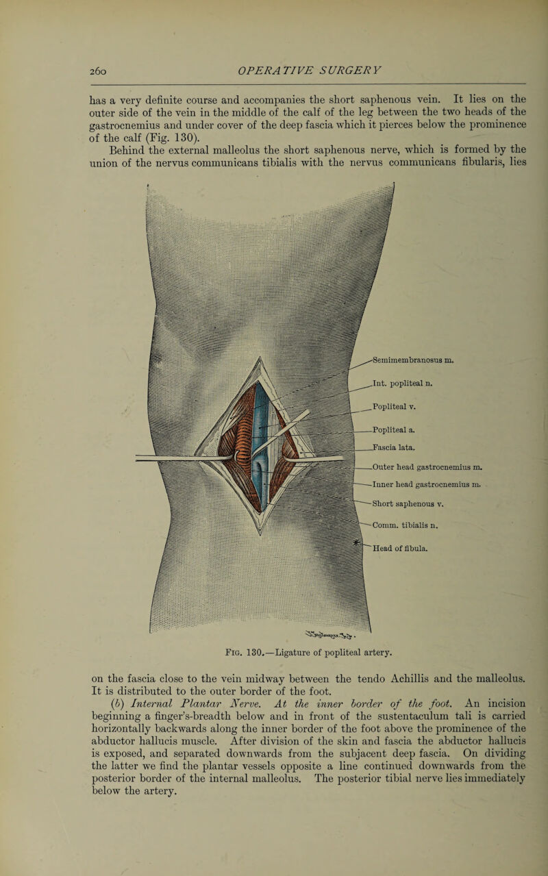 has a very definite course and accompanies the short saphenous vein. It lies on the outer side of the vein in the middle of the calf of the leg between the two heads of the gastrocnemius and under cover of the deep fascia which it pierces below the prominence of the calf (Fig. 130). Behind the external malleolus the short saphenous nerve, which is formed by the union of the nervus communicans tibialis with the nervus communicans fibularis, lies Semimembranosus m. Int. popliteal n. Popliteal v. Popliteal a. .Fascia lata. Outer head gastrocnemius m. Inner head gastrocnemius m. Short saphenous v. Comm, tibialis n. Head of fibula. Fig. 130,—Ligature of popliteal artery. on the fascia close to the vein midway between the tendo Achillis and the malleolus. It is distributed to the outer border of the foot. (6) Internal Plantar Nerve. At the inner border of the foot. An incision beginning a finger’s-breadth below and in front of the sustentaculum tali is carried horizontally backwards along the inner border of the foot above the prominence of the abductor hallucis muscle. After division of the skin and fascia the abductor hallucis is exposed, and separated downwards from the subjacent deep fascia. On dividing the latter we find the plantar vessels opposite a line continued downwards from the posterior border of the internal malleolus. The posterior tibial nerve lies immediately below the artery.