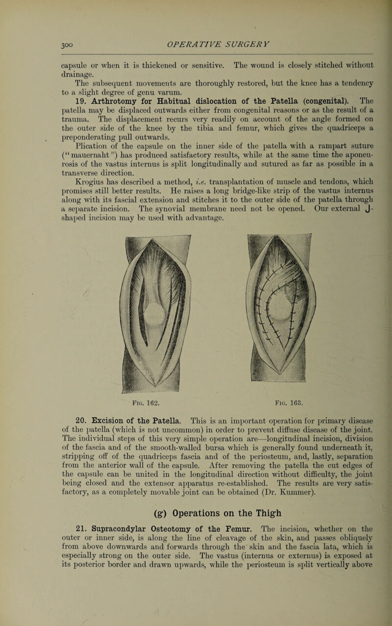 3°° capsule or when it is thickened or sensitive. The wound is closely stitched without drainage. The subsequent movements are thoroughly restored, but the knee has a tendency to a slight degree of genu varum. 19. Arthrotomy for Habitual dislocation of the Patella (congenital). The patella may be displaced outwards either from congenital reasons or as the result of a trauma. The displacement recurs very readily on account of the angle formed on the outer side of the knee by the tibia and femur, which gives the quadriceps a preponderating pull outwards. Plication of the capsule on the inner side of the patella with a rampart suture (“mauernaht”) has produced satisfactory results, while at the same time the aponeu¬ rosis of the vastus internus is split longitudinally and sutured as far as possible in a transverse direction. Krogius has described a method, i.e. transplantation of muscle and tendons, which promises still better results. He raises a long bridge-like strip of the vastus internus along with its fascial extension and stitches it to the outer side of the patella through a separate incision. The synovial membrane need not be opened. Our external J- shaped incision may be used with advantage. Fig. 162. Fig. 163. 20. Excision of the Patella. This is an important operation for primary disease of the patella (which is not uncommon) in order to prevent diffuse disease of the joint. The individual steps of this very simple operation are—longitudinal incision, division of the fascia and of the smooth-walled bursa which is generally found underneath it, stripping off of the quadriceps fascia and of the periosteum, and, lastly, separation from the anterior wall of the capsule. After removing the patella the cut edges of the capsule can be united in the longitudinal direction without difficulty, the joint being closed and the extensor apparatus re-established. The results are very satis¬ factory, as a completely movable joint can be obtained (Dr. Kummer). (g) Operations on the Thigh 21. Supracondylar Osteotomy of the Femur. The incision, whether on the outer or inner side, is along the line of cleavage of the skin, and passes obliquely from above downwards and forwards through the skin and the fascia lata, which is especially strong on the outer side. The vastus (internus or externus) is exposed at its posterior border and drawn upwards, while the periosteum is split vertically above