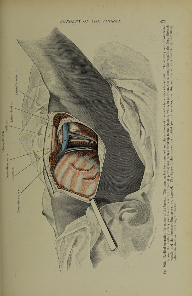 latissinras dorsi and teres major muscles.