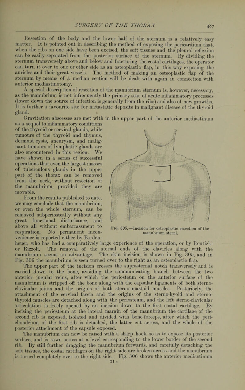 Resection of the body and the lower half of the sternum is a relatively easy matter. It is pointed out in describing the method of exposing the pericardium that, when the ribs on one side have been excised, the soft tissues and the pleural reflexion can be easily separated from the posterior surface of the sternum. By dividing the sternum transversely above and below and fracturing the costal cartilages, the operator can turn it over to one or other side as an osteoplastic flap, in this way exposing the auricles and their great vessels. The method of making an osteoplastic flap of the sternum by means of a median section will be dealt with again in connection with anterior mediastinotomy. A special description of resection of the manubrium sternum is, however, necessary, as the manubrium is not infrequently the primary seat of acute inflammatory processes (lower down the source of infection is generally from the ribs) and also of new growths. It is further a favourite site for metastatic deposits in malignant disease of the thyroid gland. >. Gravitation abscesses are met with in the upper part of the anterior mediastinum as a sequel to inflammatory conditions of the thyroid or cervical glands, while tumours of the thyroid and thymus, dermoid cysts, aneurysm, and malig¬ nant tumours of lymphatic glands are also encountered in this region. We have shown in a series of successful operations that even the largest masses of tuberculous glands in the upper part of the thorax can be removed from the neck, without l’esection of the manubrium, provided they are movable. From the results published to date, we may conclude that the manubrium, or even the whole sternum, can be removed subperiosteally without any great functional disturbance, and above all without embarrassment to respiration. No permanent incon¬ venience is reported either by Barden¬ heuer, who has had a comparatively large experience of the operation, or by Eoutizki or Rizzoli. The removal of the sternal ends of the clavicles along with the manubrium seems an advantage. The skin incision is shown in Fig. 305, and in Fig. 306 the manubrium is seen turned over to the right as an osteoplastic flap. The upper part of the incision crosses the suprasternal notch transversely and is carried down to the bone, avoiding the communicating branch between the two anterior jugular veins, after which the periosteum on the anterior surface of the manubrium is stripped off the bone along with the capsular ligaments of both sterno¬ clavicular joints and the origins of both sterno-mastoid muscles. Posteriorly, the attachment of the cervical fascia and the origins of the sterno-hyoid and sterno¬ thyroid muscles are detached along with the periosteum, and the left sterno-clavicular articulation is freely opened by an incision down to the first costal cartilage. By incising the periosteum at the lateral margin of the manubrium the cartilage of the second rib is exposed, isolated and divided with bone-forceps, after which the peri¬ chondrium of the first rib is detached, the latter cut across, and the whole of the posterior attachment of the capsule exposed. The manubrium can now be raised with a sharp hook so as to expose its posterior surface, and is sawn across at a level corresponding to the lower border of the second rib. By still further dragging the manubrium forwards, and carefully detaching the soft tissues, the costal cartilages on the right side are broken across and the manubrium is turned completely over to the right side. Fig. 306 shows the anterior mediastinum 31 c Fig. 305.—Incision for osteoplastic resection of the manubrium sterni.