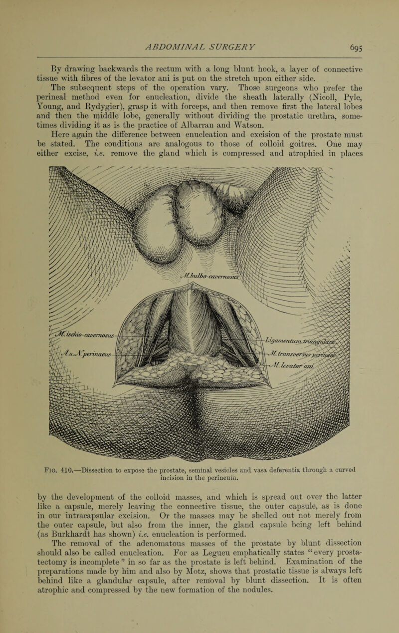 By drawing backwards the rectum with a long blunt hook, a layer of connective tissue with fibres of the levator ani is put on the stretch upon either side. The subsequent steps of the operation vary. Those surgeons who prefer the perineal method even for enucleation, divide the sheath laterally (Nicoll, Pyle, Young, and Rydygier), grasp it with forceps, and then remove first the lateral lobes and then the middle lobe, generally without dividing the prostatic urethra, some¬ times dividing it as is the practice of Albarran and Watson. Here again the difference between enucleation and excision of the prostate must be stated. The conditions are analogous to those of colloid goitres. One may either excise, i.e. remove the gland which is compressed and atrophied in places Fig. 410.—Dissection to expose the prostate, seminal vesicles and vasa deferentia through a curved incision in the perineum. by the development of the colloid masses, and which is spread out over the latter like a capsule, merely leaving the connective tissue, the outer capsule, as is done in our intracapsular excision. Or the masses may be shelled out not merely from the outer capsule, but also from the inner, the gland capsule being left behind (as Burkhardt has shown) i.e. enucleation is performed. The removal of the adenomatous masses of the prostate by blunt dissection should also be called enucleation. For as Legueu emphatically states “every prosta¬ tectomy is incomplete ” in so far as the prostate is left behind. Examination of the preparations made by him and also by Motz, shows that prostatic tissue is always left behind like a glandular capsule, after removal by blunt dissection. It is often atrophic and compressed by the new formation of the nodules.