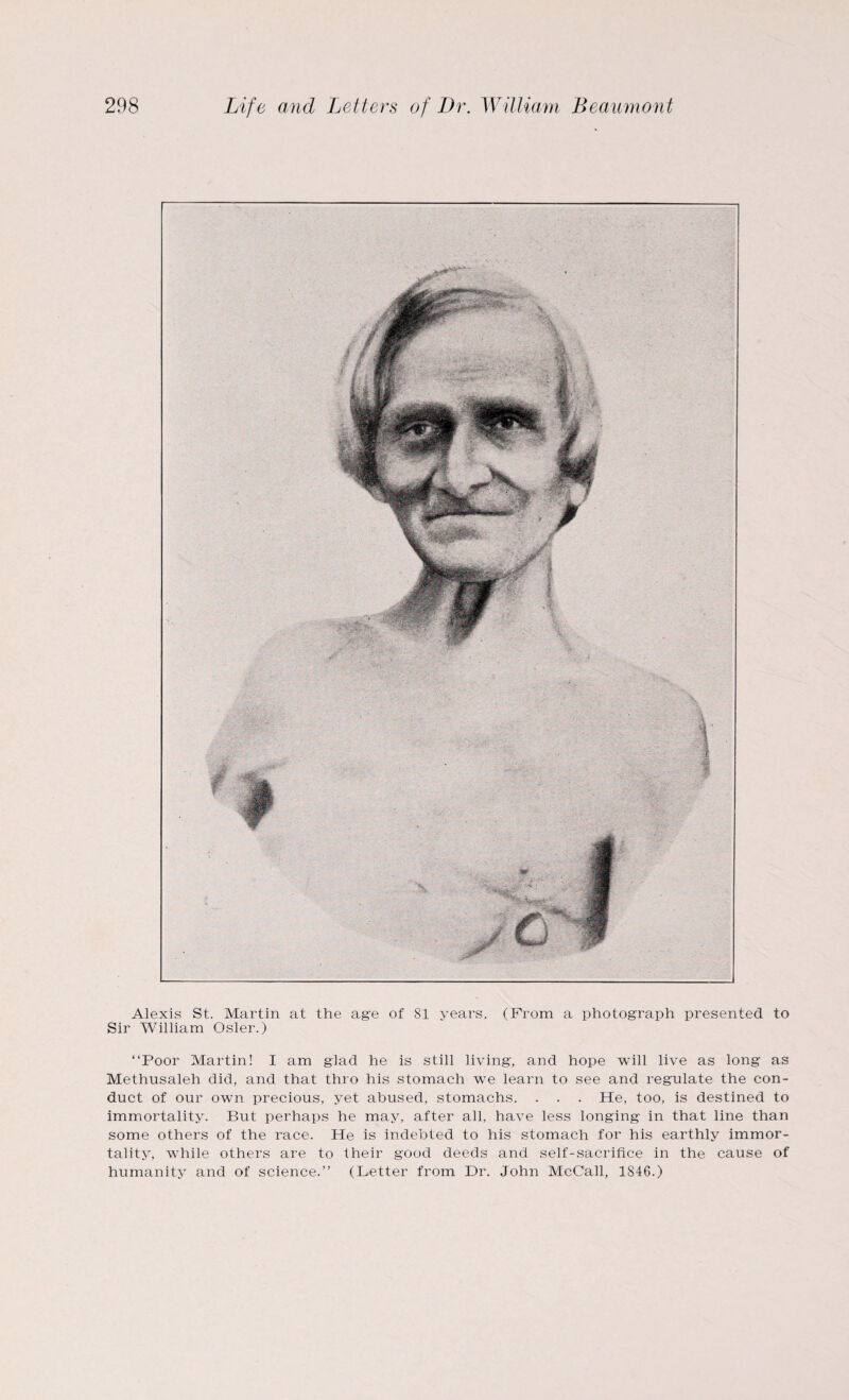 Alexis St. Martin at the age of 81 years. (From a photograph presented to Sir William Osier.) “Poor Martin! I am glad he is still living, and hope will live as long as Methusaleh did, and that thro his stomach wTe learn to see and regulate the con¬ duct of our own precious, yet abused, stomachs. . . . He, too, is destined to immortality. But perhaps he may, after all, have less longing in that line than some others of the race. He is indebted to his stomach for his earthly immor¬ tality, while others are to their good deeds and self-sacrifice in the cause of humanity and of science.’’ (Letter from Dr. John McCall, 1846.)