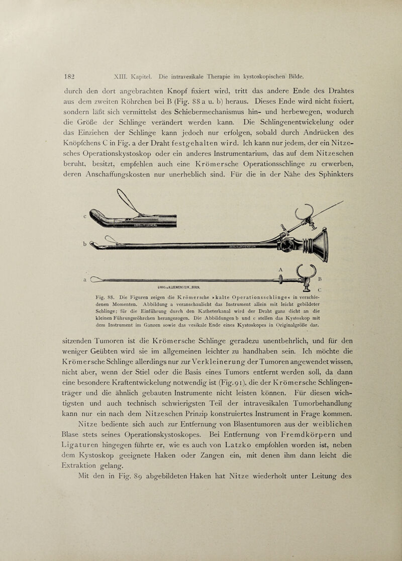 durch den dort angebrachten Knopf fixiert wird, tritt das andere Ende des Drahtes aus dem zweiten Röhrchen bei B (Fig. 88 a u. b) heraus. Dieses Ende wird nicht fixiert, sondern läßt sich vermittelst des Schiebermechanismus hin- und herbewegen, wodurch die Größe der Schlinge verändert werden kann. Die Schlingenentwickelung oder das Einziehen der Schlinge kann jedoch nur erfolgen, sobald durch Andrücken des Knöpfchens C in Füg. a der Draht festgehalten wird. Ich kann nur jedem, der ein Nitze- sches Operationskystoskop oder ein anderes Instrumentarium, das auf dem Nitzeschen beruht, besitzt, empfehlen auch eine Krömersche Operationsschlinge zu erwerben, deren Anschaffungskosten nur unerheblich sind. Für die in der Nähe des Sphinkters a -- i 10UIS U.H.L0EWENSTE1N. JERÜN. Fig. 88. Die Figuren zeigen die Krömersche > kalte Opcrationsschlinge« in verschie¬ denen Momenten. Abbildung a veranschaulicht das Instrument allein mit leicht gebildeter Schlinge; für die Einführung durch den Katheterkanal wird der Draht ganz dicht an die kleinen Führungsröhrchen herangezogen. Die Abbildungen b und c stellen das Kystoskop mit dem Instrument im Ganzen sowie das vesikale Ende eines Kystoskopes in Originalgröße dar. sitzenden Tumoren ist die Krömersche Schlinge geradezu unentbehrlich, und für den weniger Geübten wird sie im allgemeinen leichter zu handhaben sein. Ich möchte die Krömersche Schlinge allerdings nur zur Verkleinerung der Tumoren angewendet wissen, nicht aber, wenn der Stiel oder die Basis eines Tumors entfernt werden soll, da dann eine besondere Kraftentwickelung notwendig ist (Fig.91), die der Krömersche Sehlingen- träger und die ähnlich gebauten Instrumente nicht leisten können. Für diesen wich¬ tigsten und auch technisch schwierigsten Teil der intravesikalen Tumorbehandlung kann nur ein nach dem Nitzeschen Prinzip konstruiertes Instrument in Frage kommen. Nitze bediente sich auch zur Entfernung von Blasentumoren aus der weiblichen Blase stets seines Operationskystoskopes. Bei Entfernung von Fremdkörpern und Ligaturen hingegen führte er, wie es auch von Latzko empfohlen worden ist, neben dem Kystoskop geeignete Haken oder Zangen ein, mit denen ihm dann leicht die Extraktion gelang. Mit den in Fig. 89 abgebildeten Haken hat Nitze wiederholt unter Leitung des