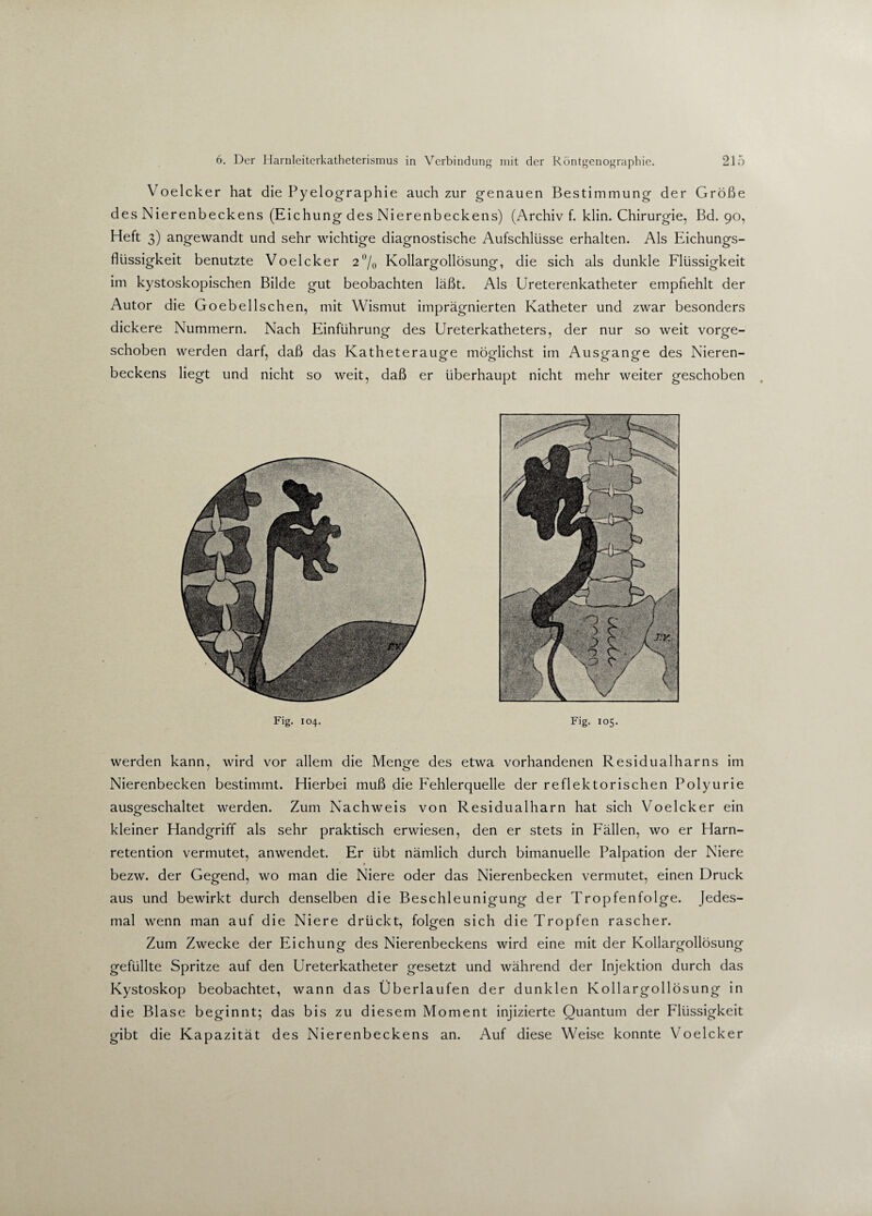 Voelcker hat die Pyelographie auch zur genauen Bestimmung der Größe des Nierenbeckens (Eichung des Nierenbeckens) (Archiv f. klin. Chirurgie, Bd. 90, Heft 3) angewandt und sehr wichtige diagnostische Aufschlüsse erhalten. Als Eichungs¬ flüssigkeit benutzte Voelcker 2% Kollargollösung, die sich als dunkle Flüssigkeit im kystoskopischen Bilde gut beobachten läßt. Als Ureterenkatheter empfiehlt der Autor die Goebellschen, mit Wismut imprägnierten Katheter und zwar besonders dickere Nummern. Nach Einführung des Ureterkatheters, der nur so weit vorge¬ schoben werden darf, daß das Katheteraugre mög-lichst im Ausganofe des Nieren- beckens liegt und nicht so weit, daß er überhaupt nicht mehr weiter geschoben Fig. 104. Fig. 105. werden kann, wird vor allem die Menge des etwa vorhandenen Residualharns im Nierenbecken bestimmt. Hierbei muß die Fehlerquelle der reflektorischen Polyurie ausgeschaltet werden. Zum Nachweis von Residualharn hat sich Voelcker ein kleiner Handgriff als sehr praktisch erwiesen, den er stets in Fällen, wo er Harn¬ retention vermutet, anwendet. Er übt nämlich durch bimanuelle Palpation der Niere 1 # bezw. der Gegend, wo man die Niere oder das Nierenbecken vermutet, einen Druck aus und bewirkt durch denselben die Beschleunigung der Tropfenfolge. Jedes¬ mal wenn man auf die Niere drückt, folgen sich die Tropfen rascher. Zum Zwecke der Eichung des Nierenbeckens wird eine mit der Kollargollösung gefüllte Spritze auf den Ureterkatheter gesetzt und während der Injektion durch das Kystoskop beobachtet, wann das Überlaufen der dunklen Kollargollösung in die Blase beginnt; das bis zu diesem Moment injizierte Quantum der Flüssigkeit gibt die Kapazität des Nierenbeckens an. Auf diese Weise konnte Voelcker