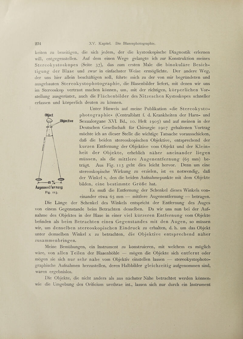 keiten zu beseitigen, die sich jedem, der die kystoskopische Diagnostik erlernen will, entgegenstellen. Auf dem einen Wege gelangte ich zur Konstruktion meines Stereokystoskopes (Seite 37), das zum ersten Male die binokulare Besich- tio-uno- der Blase und zwar in einfachster Weise ermöglichte. Der andere Weg-, der uns hier allein beschäftigen soll, führte mich zu der von mir begründeten und ausgebauten Stereokystophotographie, die Blasenbilder liefert, mit denen wir uns im Stereoskop vertraut machen können, um, mit der richtigen, körperlichen Vor¬ stellung ausgerüstet, auch die Flächenbilder des Nitzeschen Kystoskopes schneller erfassen und körperlich deuten zu können. Unter Hinweis auf meine Publikation »die Stereokysto¬ photographie« (Centralblatt f. d. Krankheiten der Harn- und Sexualorgane XVI. Bd., 10. Heft 1905) und auf meinen in der Deutschen Gesellschaft für Chirurgie 1907 gehaltenen Vortrag möchte ich an dieser Stelle die wichtige Tatsache vorausschicken, daß die beiden stereoskopischen Objektive, entsprechend der kurzen Entfernung der Objektive vom Objekt und der Klein¬ heit der Objekte, erheblich näher aneinander liegen müssen, als die mittlere Augenentfernung (65 mm) be¬ trägt. Aus Fig. 111 oreht dies leicht hervor. Denn um eine stereoskopische Wirkung zu erzielen, ist es notwendig, daß der Winkel x, den die beiden Aufnahmepunkte mit dem Objekte bilden, eine bestimmte Größe hat. Es muß die Entfernung- der Schenkel dieses Winkels von- <_> Object .„Objective i\ :U4 E \ K -65 %—* AngeDentfernuaj Fig- in¬ einander etwa 65 mm — mittlere Augenentfernung — betragen. Die Länge der Schenkel des Winkels entspricht der Entfernung des Auges von einem Gegenstände beim Betrachten desselben. Da wir uns nun bei der Auf¬ nahme des Objektes in der Blase in einer viel kürzeren Entfernung vom Objekte befinden als beim Betrachten eines Gegenstandes mit den Augen, so müssen wir, um denselben stereoskopischen Eindruck zu erhalten, d. h. um das Objekt unter demselben Winkel x zu betrachten, die Objektive entsprechend näher zusammenbringen. Meine Bemühungen, ein Instrument zu konstruieren, mit welchem es möglich wäre, von allen Teilen der Blasenhöhle — mögen die Objekte sich entfernt oder mögen sie sich nur sehr nahe vom Objektiv einstellen lassen — stereokystophoto- graphische Aufnahmen herzustellen, deren Halbbilder gleichzeitig aufgenommen sind, waren ergebnislos. Die Objekte, die nicht anders als aus nächster Nähe betrachtet werden können, wie die Umgebung des Orificium urethrae int., lassen sich nur durch ein Instrument