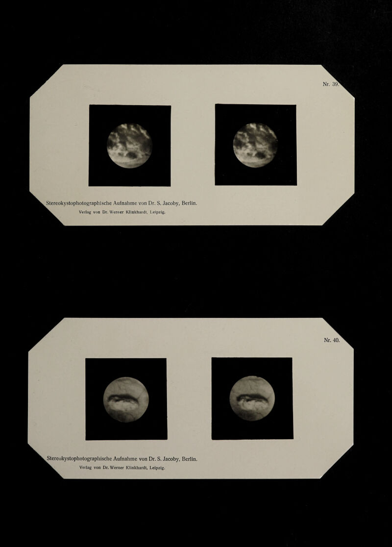 Stereukystophotograpliische Aufnahme von Dr. S. Jacoby, Berlin.