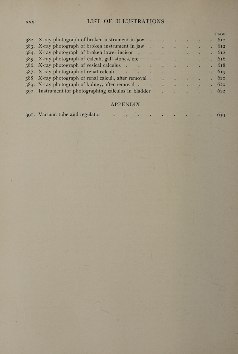 382. 3^3- 3^4- 385- 386. 387- 388. 3§9* 39°- 391- LIST OF ILLUSTRATIONS PAGE X-ray photograph of broken instrument in jaw . . . . . .612 X-ray photograph of broken instrument in jaw . . . . . .612 X-ray photograph of broken lower incisor . . . . . . .612 X-ray photograph of calculi, gall stones, etc. . . . . . .616 X-ray photograph of vesical calculus . . . . . . . .618 X-ray photograph of renal calculi . . . . . . . .619 X-ray photograph of renal calculi, after removal ...... 620 X-ray photograph of kidney, after removal ....... 620 Instrument for photographing calculus in bladder ..... 622 APPENDIX Vacuum tube and regulator . . . . . . . . . 639