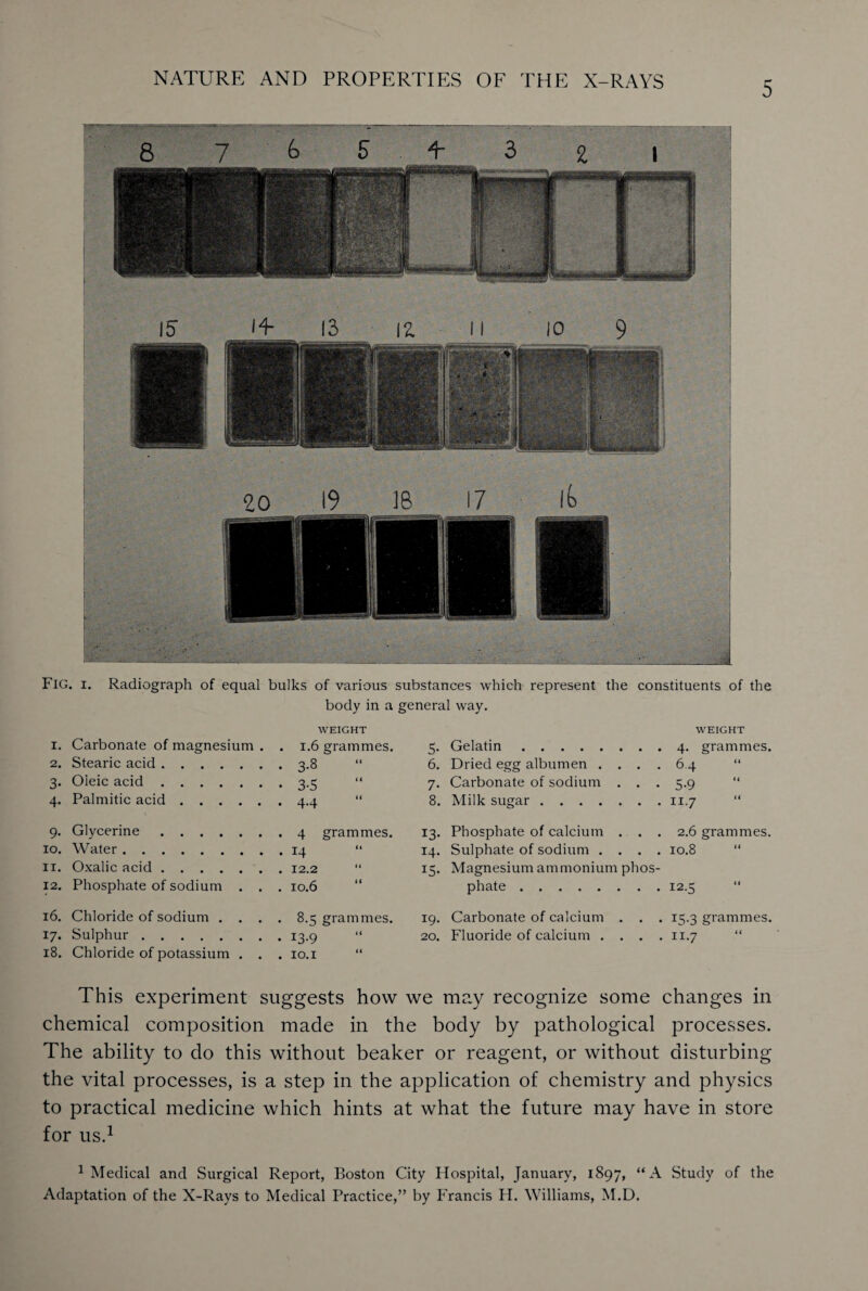 Fig. i. Radiograph of equal bulks of various substances which represent the constituents of the body in a general way. WEIGHT I. Carbonate of magnesium . . 1.6 grammes. 2. Stearic acid. . 3.8 3- Oleic acid. • 3-5 4- Palmitic acid. . 4-4 9- Glycerine. . 4 grammes. 10. Water. . 14 11. Oxalic acid. 12. Phosphate of sodium . . . 10.6 16. Chloride of sodium . . . . 8.5 grammes. 17. Sulphur. . 13.9 18. Chloride of potassium . . . IO.I “ WEIGHT 5- Gelatin. 4- grammes. 6. Dried egg albumen .... 64 tt 7* Carbonate of sodium . . . 5-9 11 8. Milk sugar. 11.7 tt 13- Phosphate of calcium . . . 2.6 grammes. 14. Sulphate of sodium .... 10.8 it IS* Magnesium ammonium phos- phate. 12.5 (i 19. Carbonate of calcium . . . 13.3 grammes. 20. Fluoride of calcium . . . . 11 -7 ft This experiment suggests how we may recognize some changes in chemical composition made in the body by pathological processes. The ability to do this without beaker or reagent, or without disturbing the vital processes, is a step in the application of chemistry and physics to practical medicine which hints at what the future may have in store for us.1 1 Medical and Surgical Report, Boston City Hospital, January, 1897, “A Study of the Adaptation of the X-Rays to Medical Practice,” by Francis H. Williams, M.D.