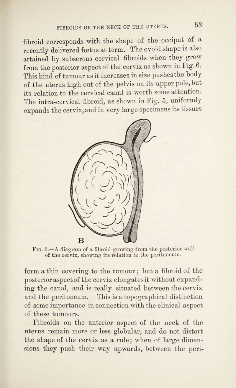 fibroid corresponds with the shape of the occiput of a recently delivered foetus at term. The ovoid shape is also attained by subserous cervical fibroids when they grow from the posterior aspect of the cervix as shown in Fig. 6. This kind of tumour as it increases in size pushes the body of the uterus high out of the pelvis on its upper pole, but its relation to the cervical canal is worth some attention. The intra-cervical fibroid, as shown in Fig. 5, uniformly expands the cervix, and in very large specimens its tissues Fig. 6.—A diagram of a fibroid growing from the posterior wall of the cervix* showing its relation to the peritoneum. form a thin covering to the tumour; but a fibroid of the posterior aspect of the cervix elongates it without expand¬ ing the canal, and is really situated between the cervix and the peritoneum. This is a topographical distinction of some importance in connection with the clinical aspect of these tumours. Fibroids on the anterior aspect of the neck of the uterus remain more or less globular, and do not distort the shape of the cervix as a rule; when of large dimen¬ sions they push their way upwards, between the peri-