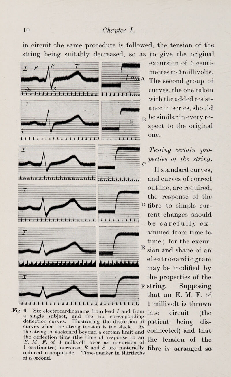 in circuit the same procedure is followed, the tension of the string being suitably decreased, so as to give the original excursion of 3 centi- §HA ill l.l.ill.U.1 I U.U.i_ mTTFFEH metres to 3millivolts. The second group of curves, the one taken with the added resist¬ ance in series, should B be similar in every re¬ spect to the original one. — C tt;£kk;iAAAAA.LLtirkkizb; rJAAihLLLEEh Testing certain pro¬ perties of the string. If standard curves, and curves of correct outline, are required, the response of the D fibre to simple cur¬ rent changes should be carefully ex¬ amined from time to time ; for the excur- E sion and shape of an electrocardiogram may be modified by the properties of the F string. Supposing that an E. M. F. of 1 millivolt is thrown J?ig. 6. Six electrocardiograms from lead I and from a single subject, and the six corresponding- deflection curves. Illustrating the distortion of curves when the string tension is too slack. As the string is slackened beyond a certain limit and the deflection time (the time of response to an E. M. F. of 1 millivolt over an excursion of 1 centimetre) increases, R and S are materially reduced in amplitude. Time-marker in thirtieths of a second. into circuit (the patient being dis¬ connected) and that the tension of the fibre is arranged so