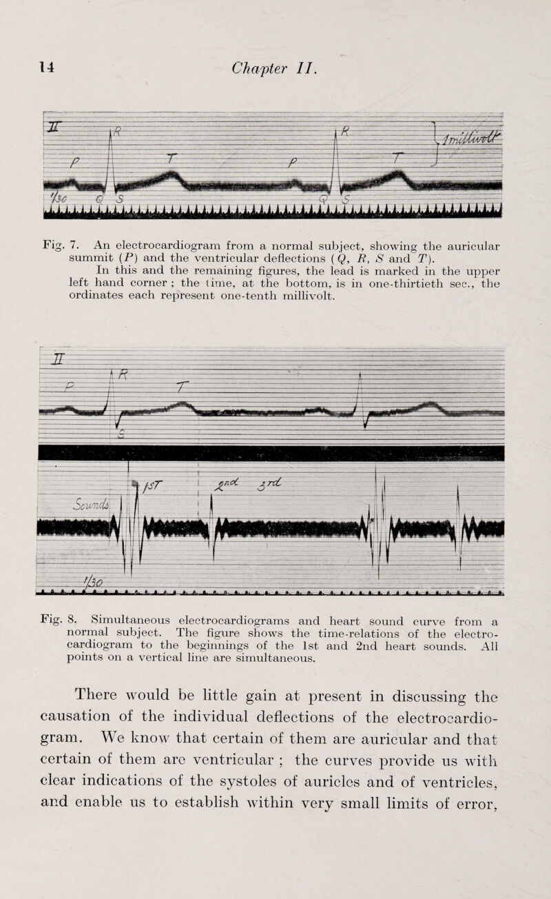 Fig. 7. An electrocardiogram from a normal subject, showing the auricular summit (P) and the ventricular deflections (Q, R, S and T). In this and the remaining figures, the lead is marked in the upper left hand corner ; the time, at the bottom, is in one-thirtieth sec., the ordinates each represent one-tenth millivolt. Fig. 8. Simultaneous electrocardiograms and heart sound curve from a normal subject. The figure shows the time-relations of the electro¬ cardiogram to the beginnings of the 1st and 2nd heart sounds. All points on a vertical line are simultaneous. There would be little gain at present in discussing the causation of the individual deflections of the electrocardio¬ gram. We know that certain of them are auricular and that certain of them are ventricular ; the curves provide us with clear indications of the systoles of auricles and of ventricles, and enable us to establish within very small limits of error,
