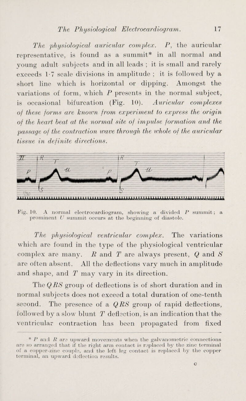 The physiological auricular complex. P, the auricular representative, is found as a summit* in all normal and young adult subjects and in all leads ; it is small and rarely exceeds 1*7 scale divisions in amplitude ; it is followed by a short line which is horizontal or dipping. Amongst the variations of form, which P presents in the normal subject, is occasional bifurcation (Fig. 10). Auricular complexes of these forms are known from experiment to express the origin of the heart heat at the normal site of impulse formation and the passage of the contraction wave through the whole of the auricidar tissue in definite directions. Fig. 10. A normal electrocardiogram, showing a divided P summit; a prominent U summit occurs at the beginning of diastole. The physiological ventricular complex. The variations which are found in the type of the physiological ventricular complex are many. R and T are always present, Q and S are often absent. All the deflections vary much in amplitude and shape, and T may vary in its direction. The$i?A group of deflections is of short duration and in normal subjects does not exceed a total duration of one-tenth second. The presence of a QRS group of rapid deflections, followed by a slow blunt T deflection, is an indication that the ventricular contraction has been propagated from fixed * P and K arc upward movements when the galvanometric connections are so arranged that if the right arm contact is replaced by the zinc terminal of a copper-zinc couple, and the left leg contact is replaced by the copper terminal, an upward deflection results.