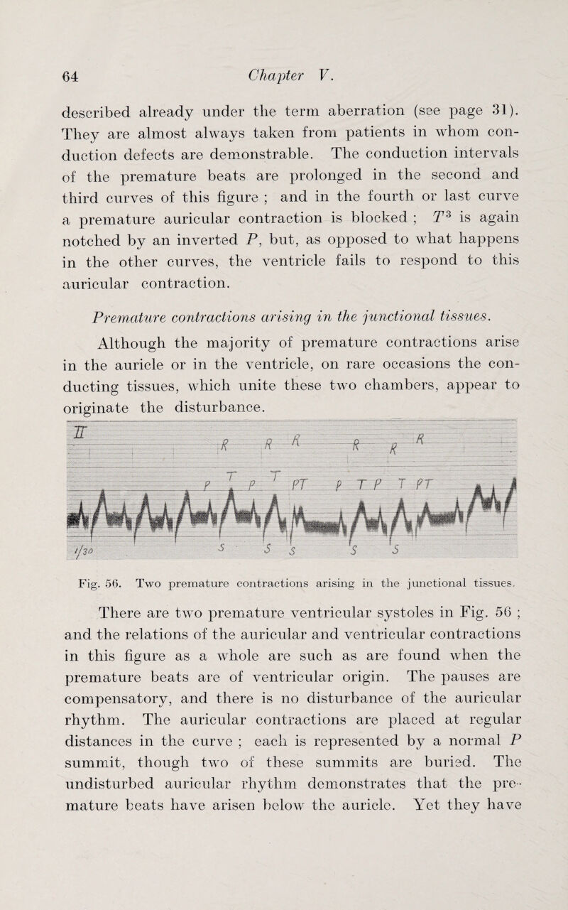 described already under the term aberration (see page 31). They are almost always taken from patients in whom con¬ duction defects are demonstrable. The conduction intervals of the premature beats are prolonged in the second and third curves of this figure ; and in the fourth or last curve a premature auricular contraction is blocked ; T3 is again notched by an inverted P, but, as opposed to what happens in the other curves, the ventricle fails to respond to this auricular contraction. Premature contractions arising in the junctional tissues. Although the majority of premature contractions arise in the auricle or in the ventricle, on rare occasions the con¬ ducting tissues, which unite these two chambers, appear to originate the disturbance. Fig. 56. Two premature contractions arising in the junctional tissues. There are two premature ventricular systoles in Fig. 56 ; and the relations of the auricular and ventricular contractions in this figure as a whole are such as are found when the premature beats are of ventricular origin. The pauses are compensatory, and there is no disturbance of the auricular rhythm. The auricular contractions are placed at regular distances in the curve ; each is represented by a normal P summit, though two of these summits are buried. The undisturbed auricular rhythm demonstrates that the pre¬ mature beats have arisen below the auricle. Yet they have