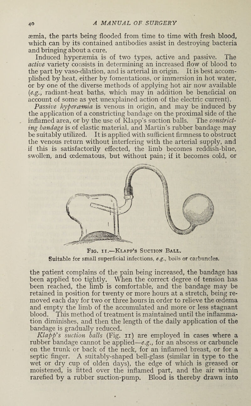 aemia, the parts being flooded from time to time with fresh blood, which can by its contained antibodies assist in destroying bacteria and bringing about a cure. Induced hyperaemia is of two types, active and passive. The active variety consists in determining an increased flow of blood to the part by vaso-dilation, and is arterial in origin. It is best accom¬ plished by heat, either by fomentations, or immersion in hot water, or by one of the diverse methods of applying hot air now available (.e.g., radiant-heat baths, which may in addition be beneficial on account of some as yet unexplained action of the electric current). Passive hypercemia is venous in origin, and may be induced by the application of a constricting bandage on the proximal side of the inflamed area, or by the use of Klapp’s suction balls. The constrict¬ ing bandage is of elastic material, and Martin’s rubber bandage may be suitably utilized. It is applied with sufficient firmness to obstruct the venous return without interfering with the arterial supply, and if this is satisfactorily effected, the limb becomes reddish-blue, swollen, and oedematous, but without pain; if it becomes cold, or Suitable for small superficial infections, e.g., boils or carbuncles. the patient complains of the pain being increased, the bandage has been applied too tightly. When the correct degree of tension has been reached, the limb is comfortable, and the bandage may be retained in position for twenty or more hours at a stretch, being re¬ moved each day for two or three hours in order to relieve the oedema and empty the limb of the accumulated and more or less stagnant blood. This method of treatment is maintained until the inflamma¬ tion diminishes, and then the length of the daily application of the bandage is gradually reduced. Klapp’s suction balls (Fig. n) are employed in cases where a rubber bandage cannot be applied—e.g., for an abscess or carbuncle on the trunk or back of the neck, for an inflamed breast, or for a septic finger. A suitably-shaped bell-glass (similar in type to the wet or dry cup of olden days), the edge of which is greased or moistened, is fitted over the inflamed part, and the air within rarefied by a rubber suction-pump. Blood is thereby drawn into