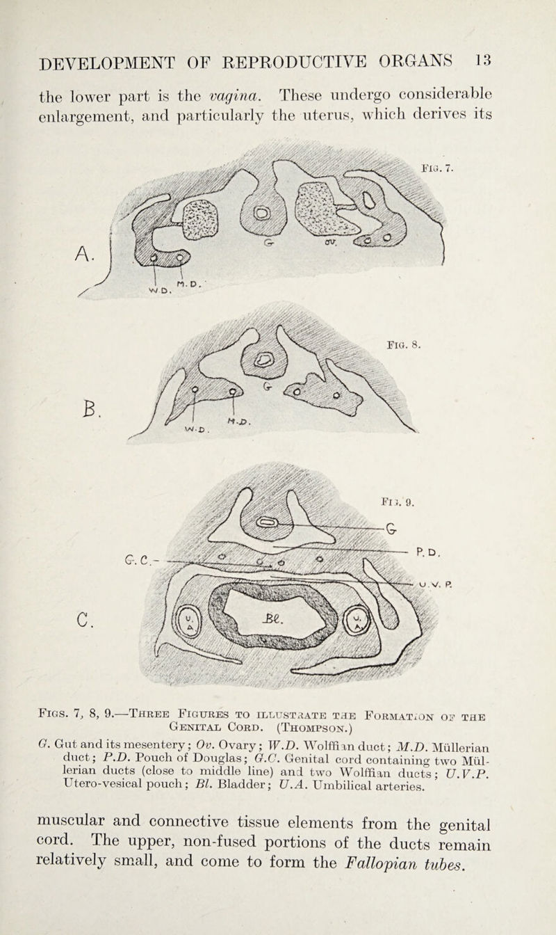 the lower part is the vagina. These undergo considerable enlargement, and particularly the uterus, which derives its Figs. 7, 8, 9.—Three Figures to illustrate the Formation oe the Genital Cord. (Thompson.) G. Gut and its mesentery; Ov. Ovary; W.D. Wolffian duct; M.D. Mullerian duct; P.D. Pouch of Douglas; G.C. Genital cord containing two Mul¬ lerian ducts (close to middle line) and two Wolffian ducts; U.V.P. Utero-vesical pouch; Bl. Bladder; U.A. Umbilical arteries. muscular and connective tissue elements from the genital cord. The upper, non-fused portions of the ducts remain relatively small, and come to form the Fallopian tubes.