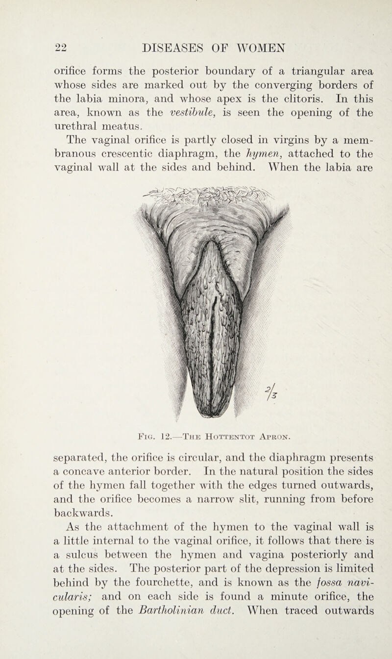 orifice forms the posterior boundary of a triangular area whose sides are marked out by the converging borders of the labia minora, and whose apex is the clitoris. In this area, known as the vestibule, is seen the opening of the urethral meatus. The vaginal orifice is partly closed in virgins by a mem¬ branous crescentic diaphragm, the hymen, attached to the vaginal wall at the sides and behind. When the labia are Fig. 12.—The Hottentot Apron. separated, the orifice is circular, and the diaphragm presents a concave anterior border. In the natural position the sides of the hymen fall together with the edges turned outwards, and the orifice becomes a narrow slit, running from before backwards. As the attachment of the hymen to the vaginal wall is a little internal to the vaginal orifice, it follows that there is a sulcus between the hymen and vagina posteriorly and at the sides. The posterior part of the depression is limited behind by the fourchette, and is known as the fossa navi- cularis; and on each side is found a minute orifice, the opening of the Bartholinian duct. When traced outwards