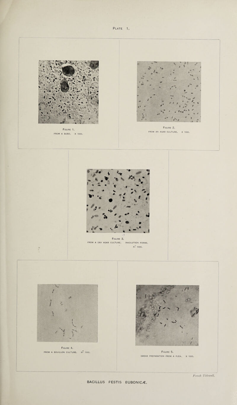 Figure 1. FROM A BUBO. X 1000. . I Figure 3. FROM A DRY AGAR CULTURE. INVOLUTION FORMS. Xc 1000. Figure 4. FROM A BOUILLON CULTURE. XC 1000. Figure 5. SMEAR PREPARATION FROM A FLEA. X 1000. Frank Tidwell
